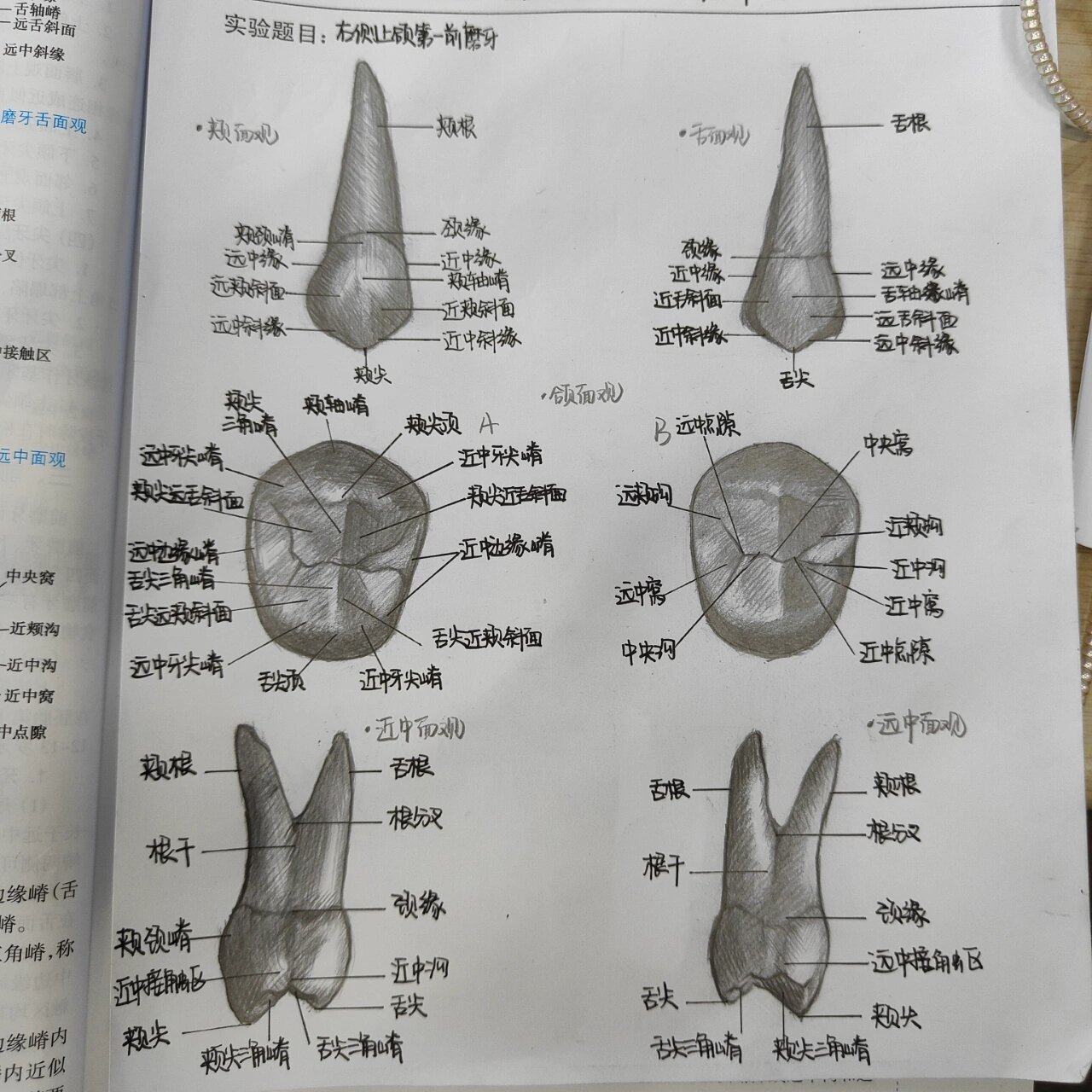 上颌第一磨牙描绘图图片