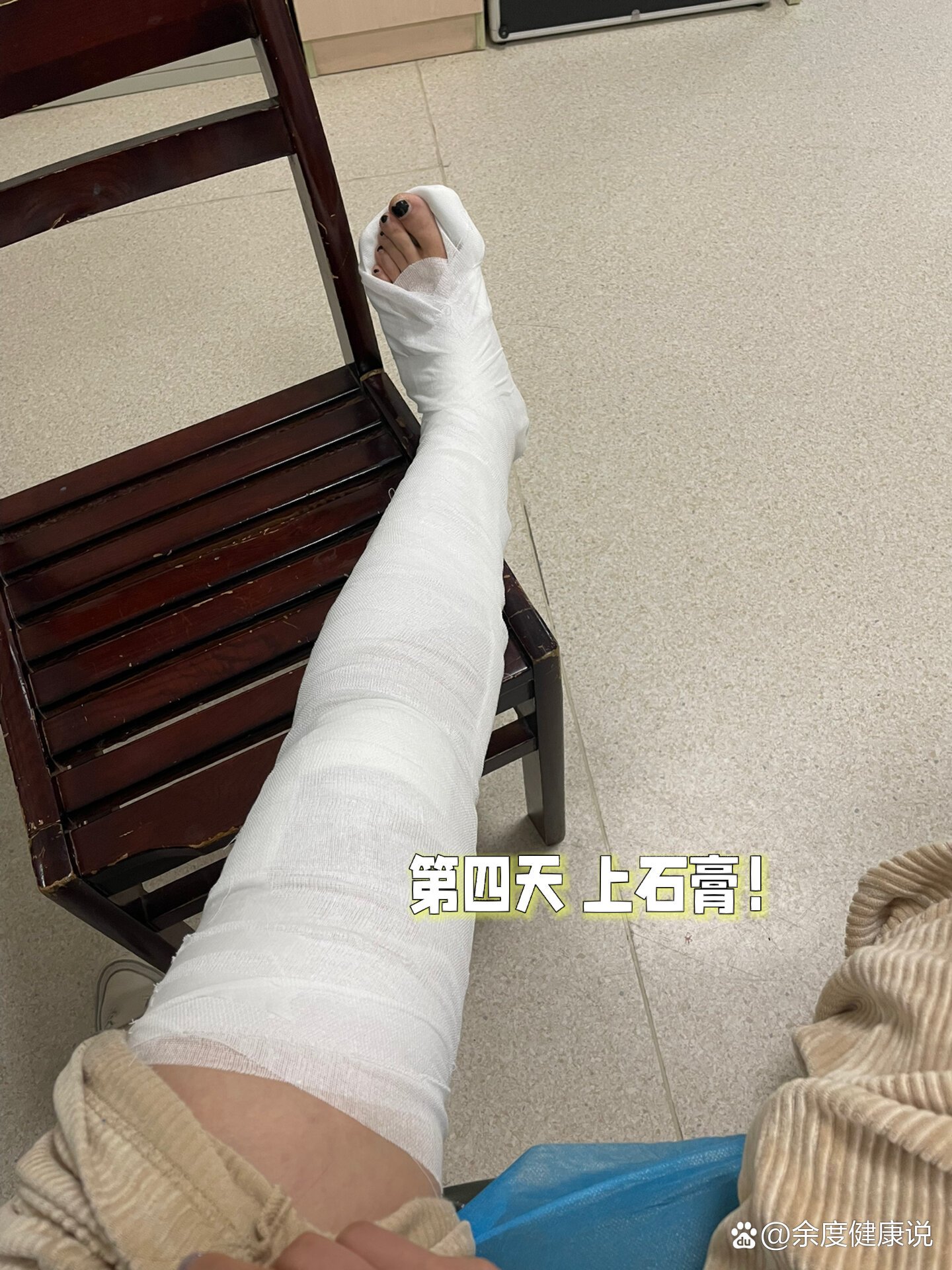 髌骨内外侧支持带撕裂,本雪季宣告结束🔚