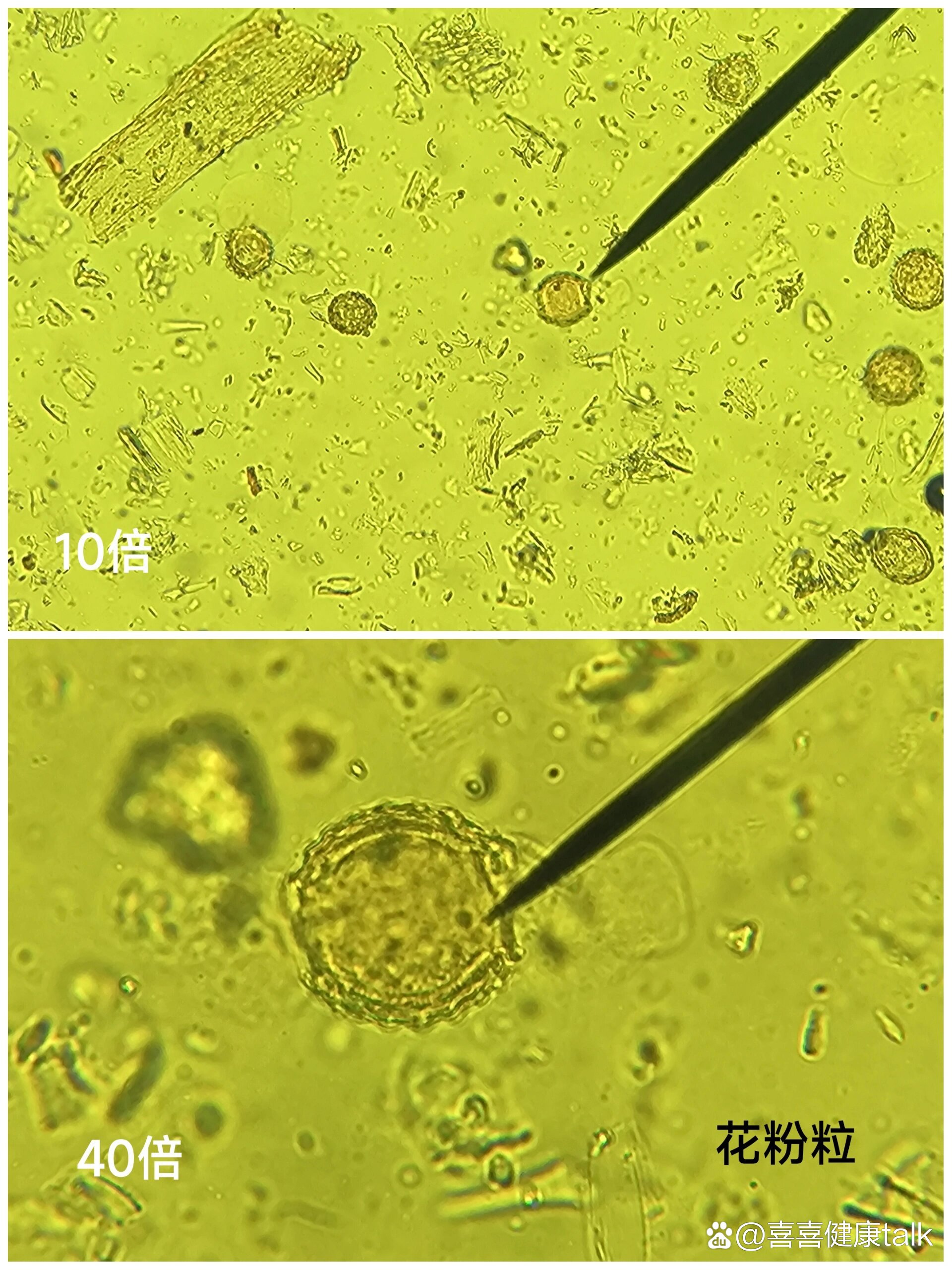  p>红花的显微鉴别特征 br>1.花粉粒  br>2.分泌细胞  br>3.