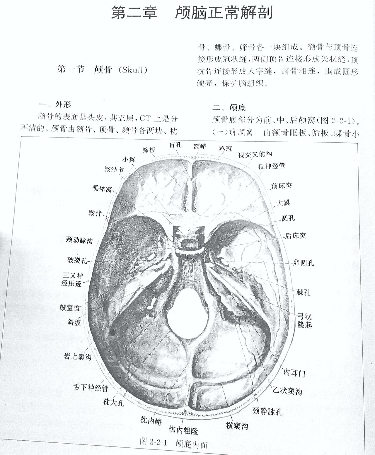 小脑蚓部正常影像解剖图片