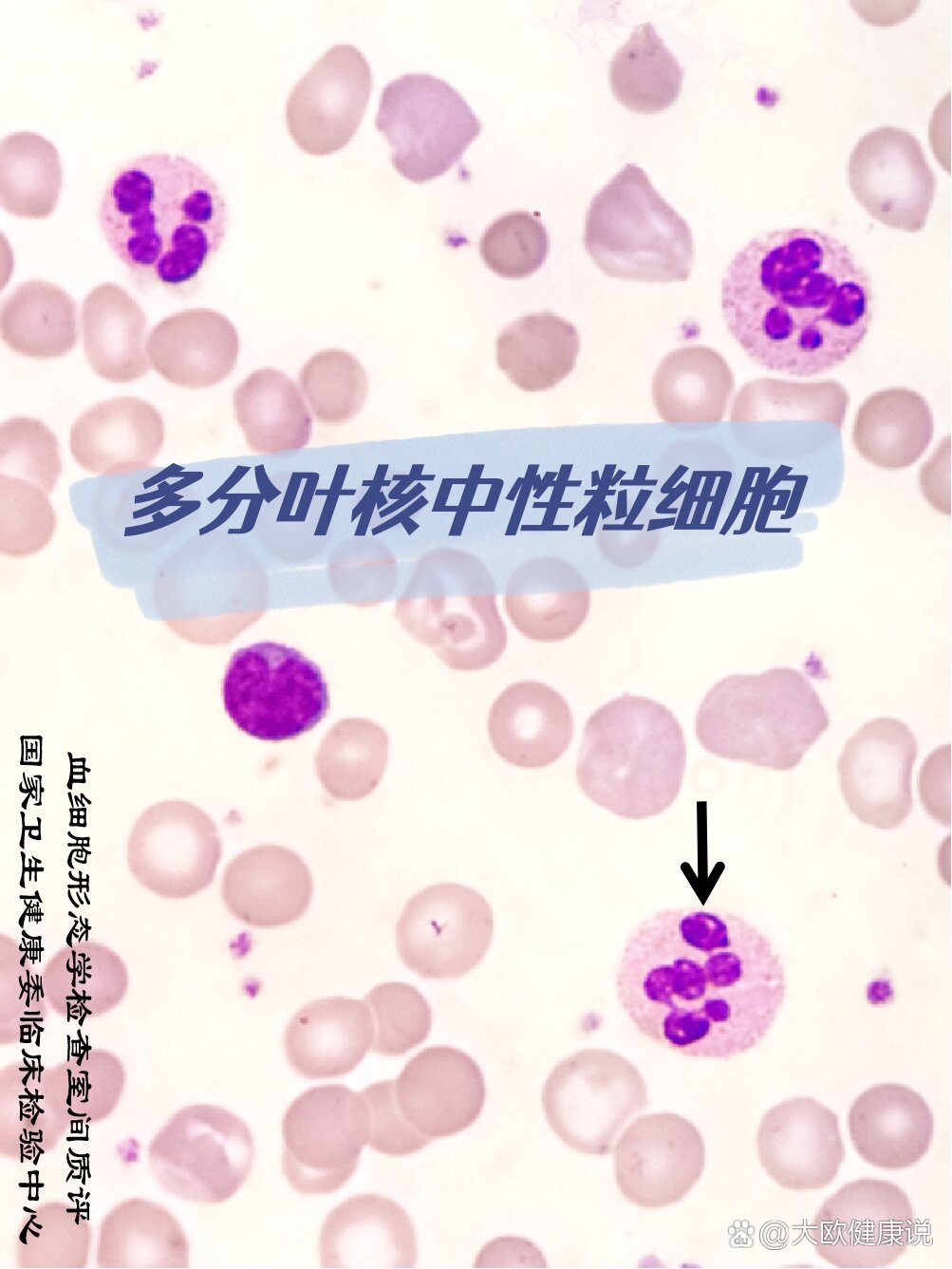 中性粒细胞图片 全网资源