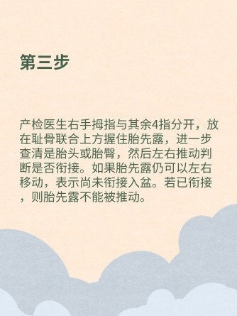 四步触诊法是产前检查最常用的方法,可以判定胎儿的位置和大小,子宫