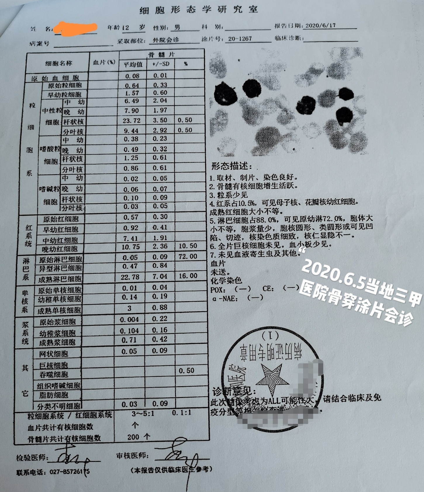 儿子的五次骨穿结果