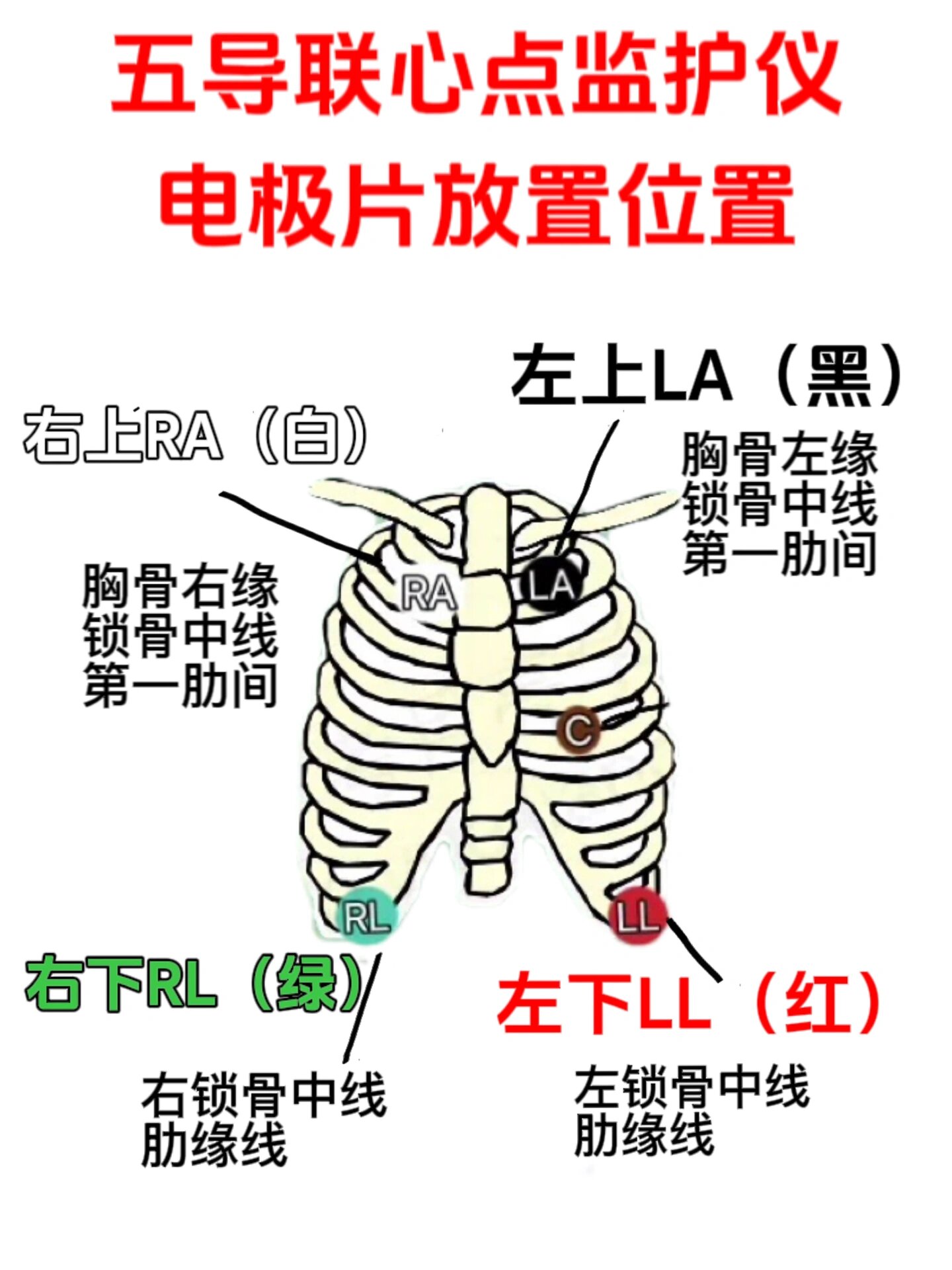 心电监护仪位置图图片