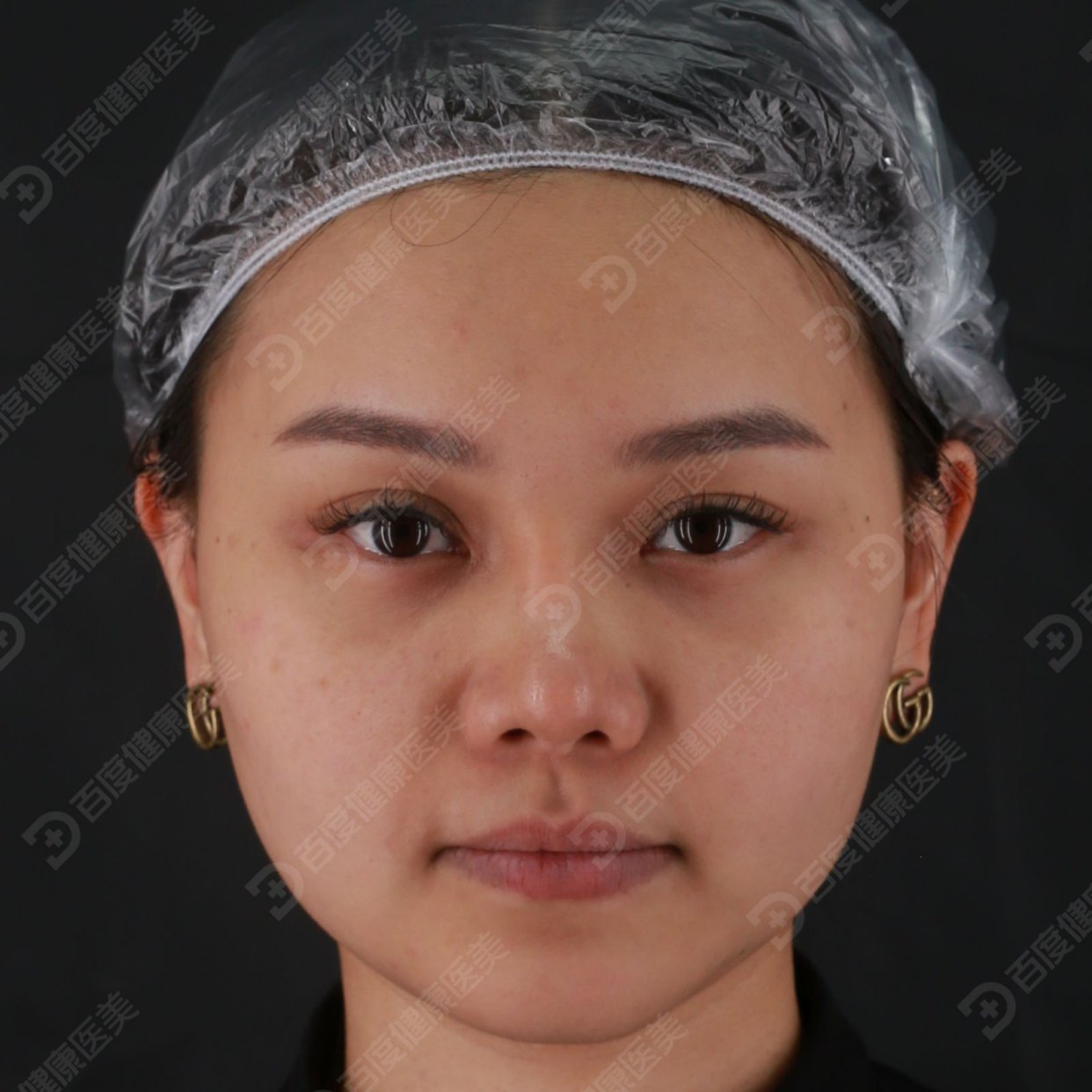 抗衰老过程，亚洲女性面部肌肤具有抗衰老的程序，嫩肤、提拉、紧致面部肌肤，恢复青春抗皱肌肤。老与年轻的概念。照片摄影图片_ID:317812646-Veer图库