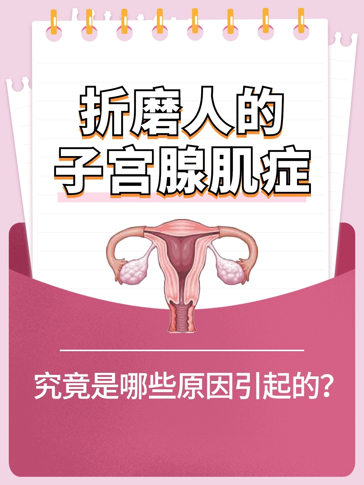 折磨人的子宫腺肌症