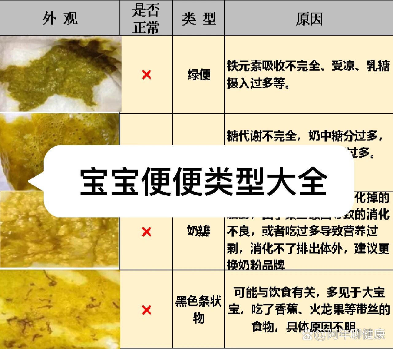 宝宝大便类型全解(一)