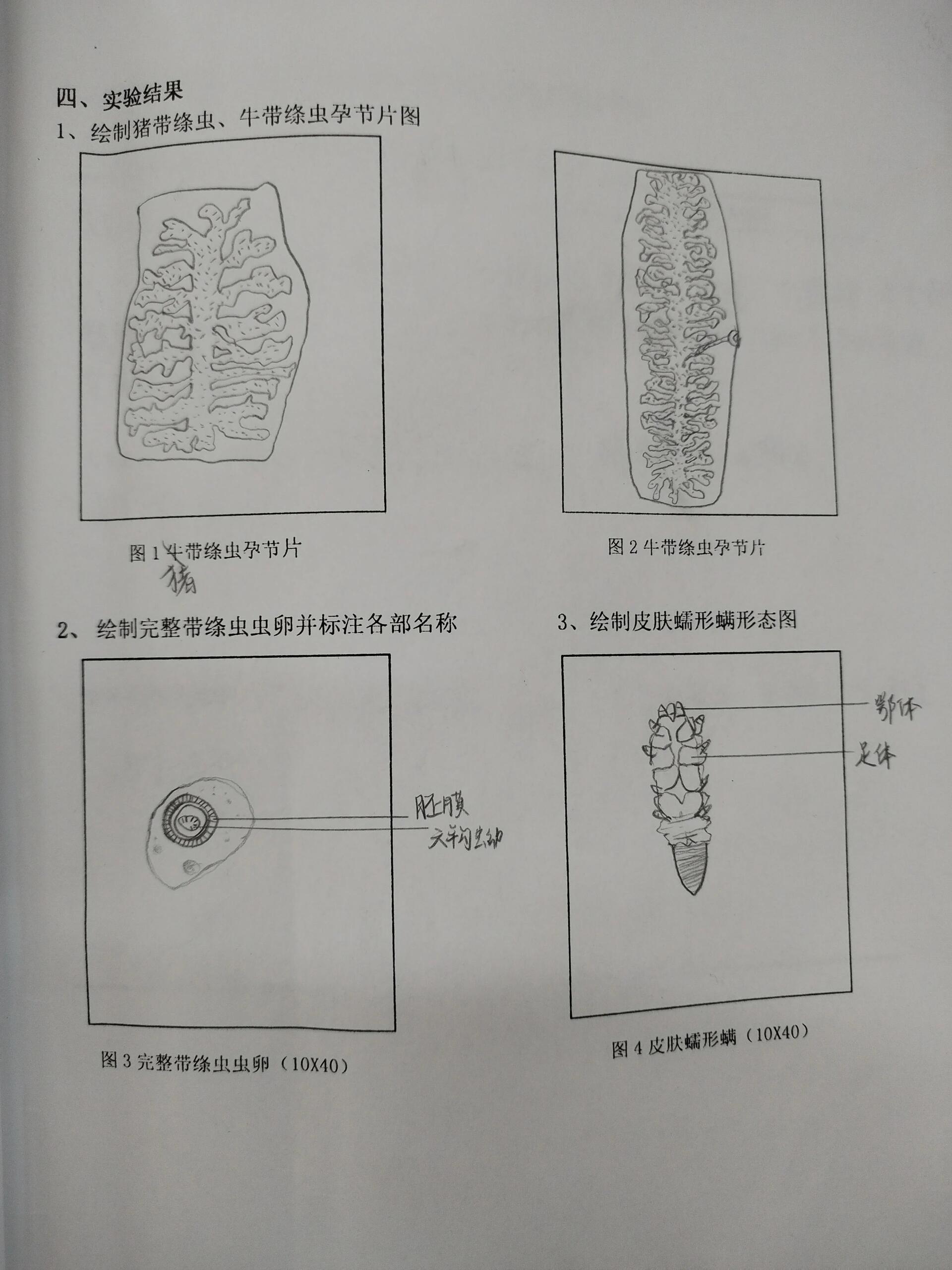 犬弓首蛔虫虫卵手绘图图片