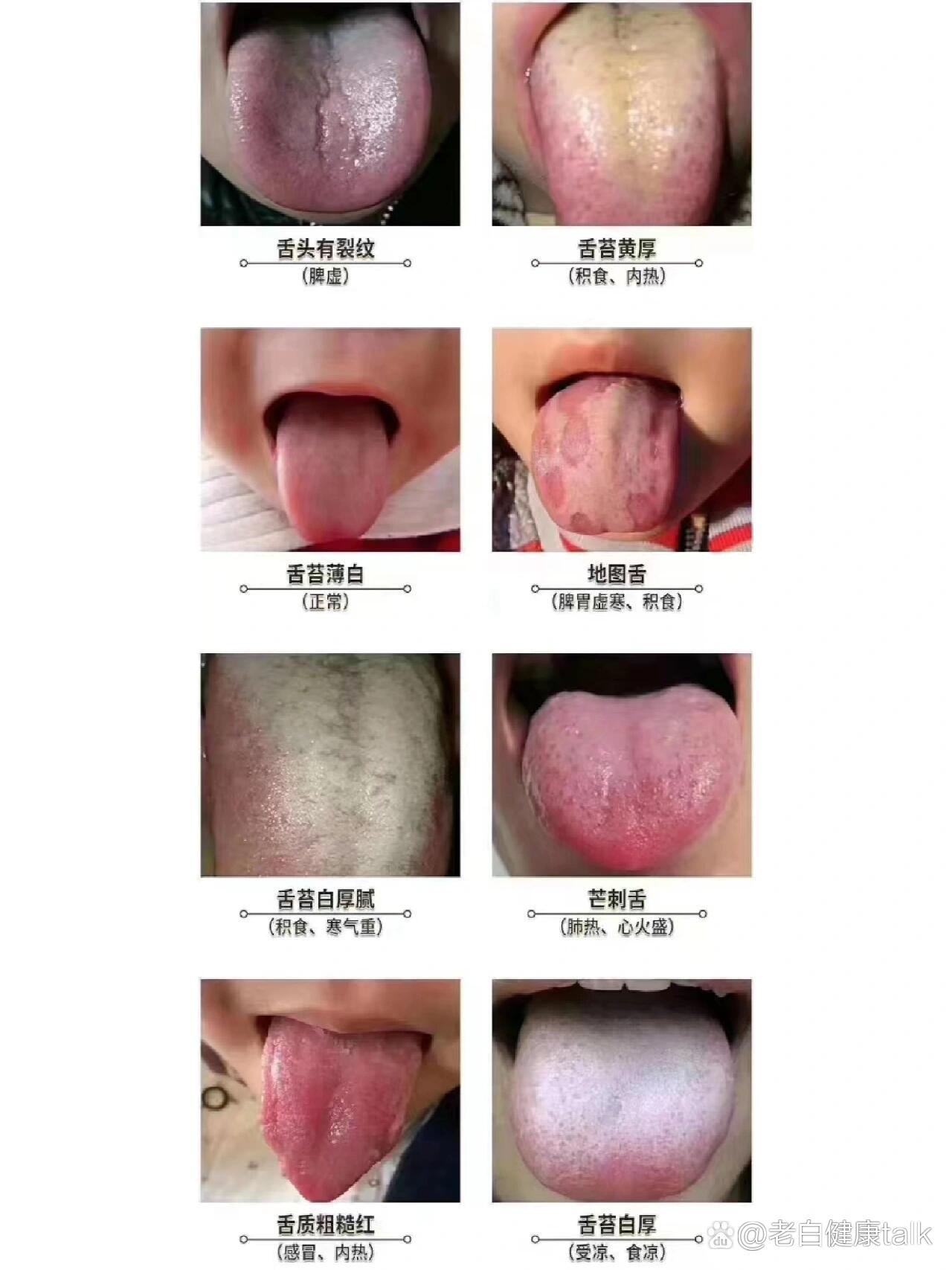 宝宝是积食还是脾虚积食?