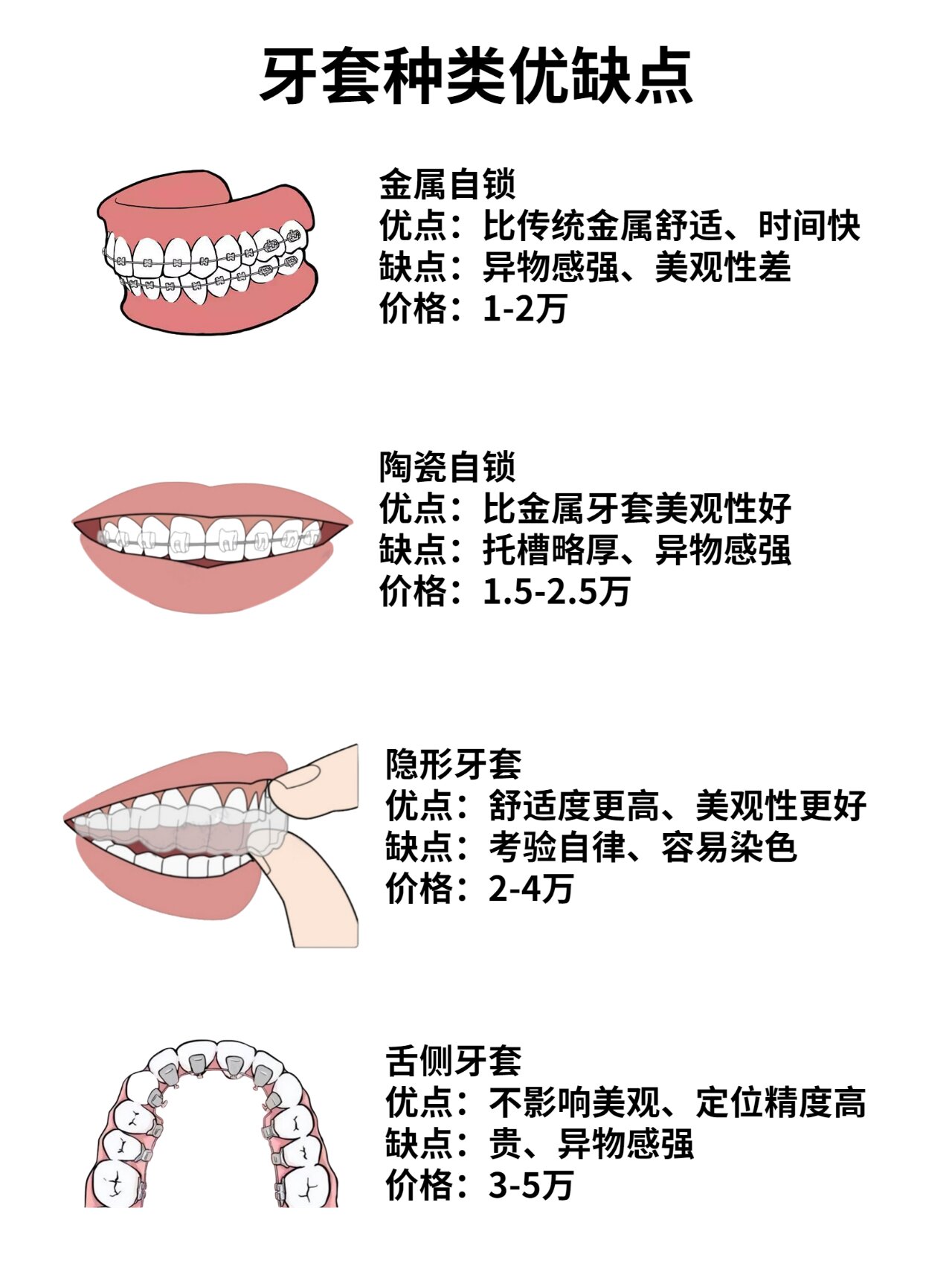 牙套脸 图解图片