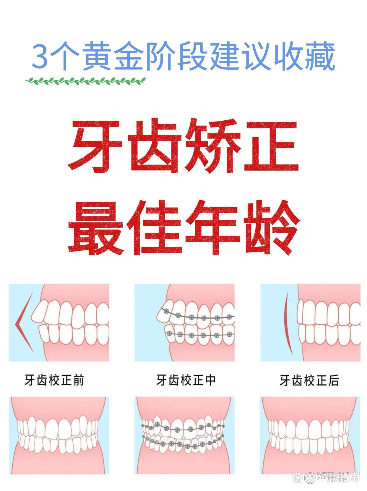 颌骨矫正图片