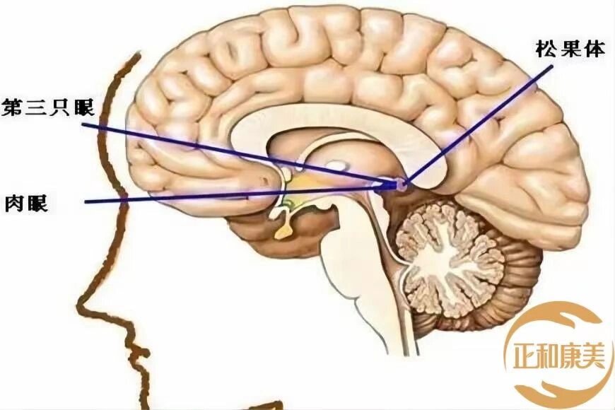 松果体的准确位置图图片