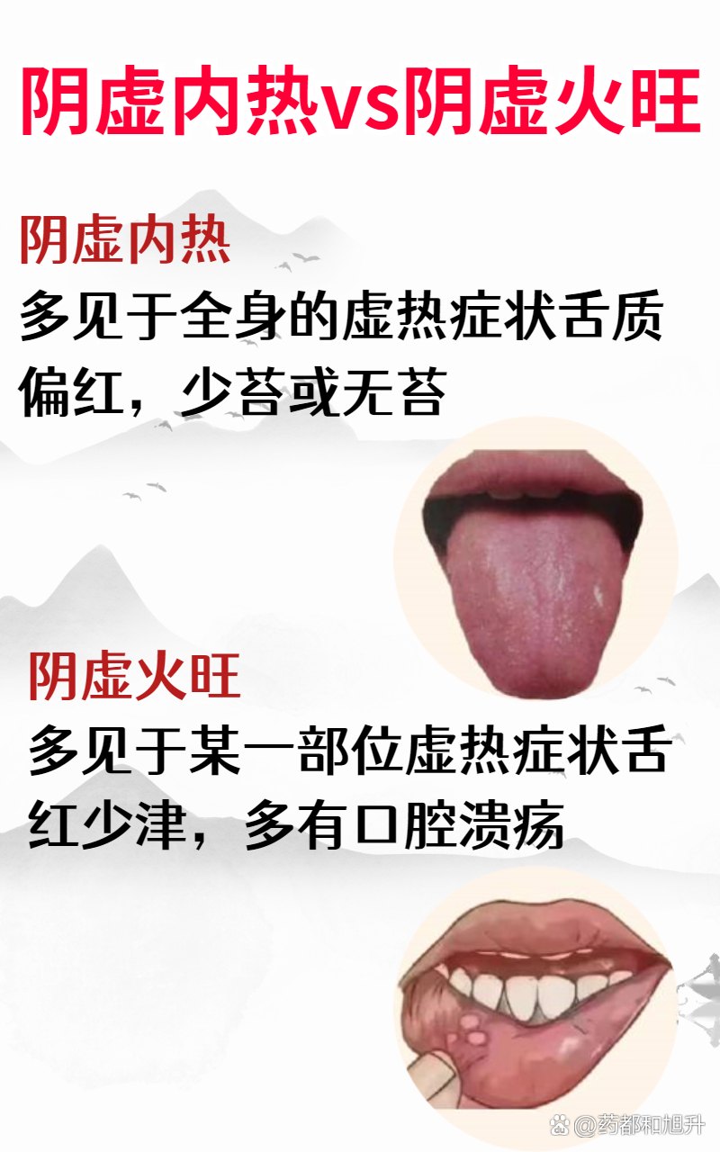 阴虚内热和阴虚火旺有什么区别？