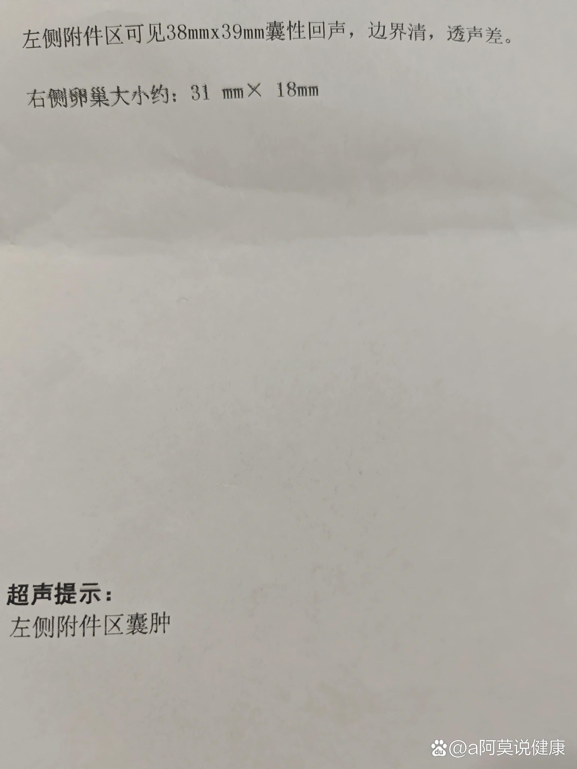 左侧附件囊肿