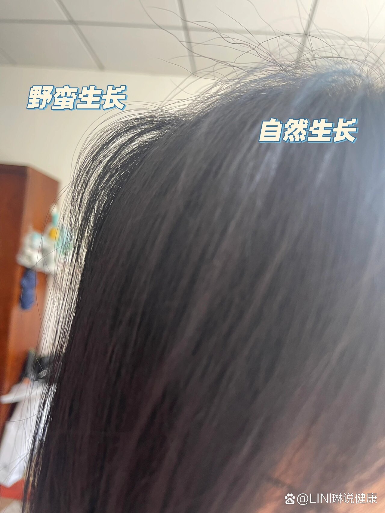 毕竟头发少  br>但是 它忽然冒出一小撮 关键 翘起来!