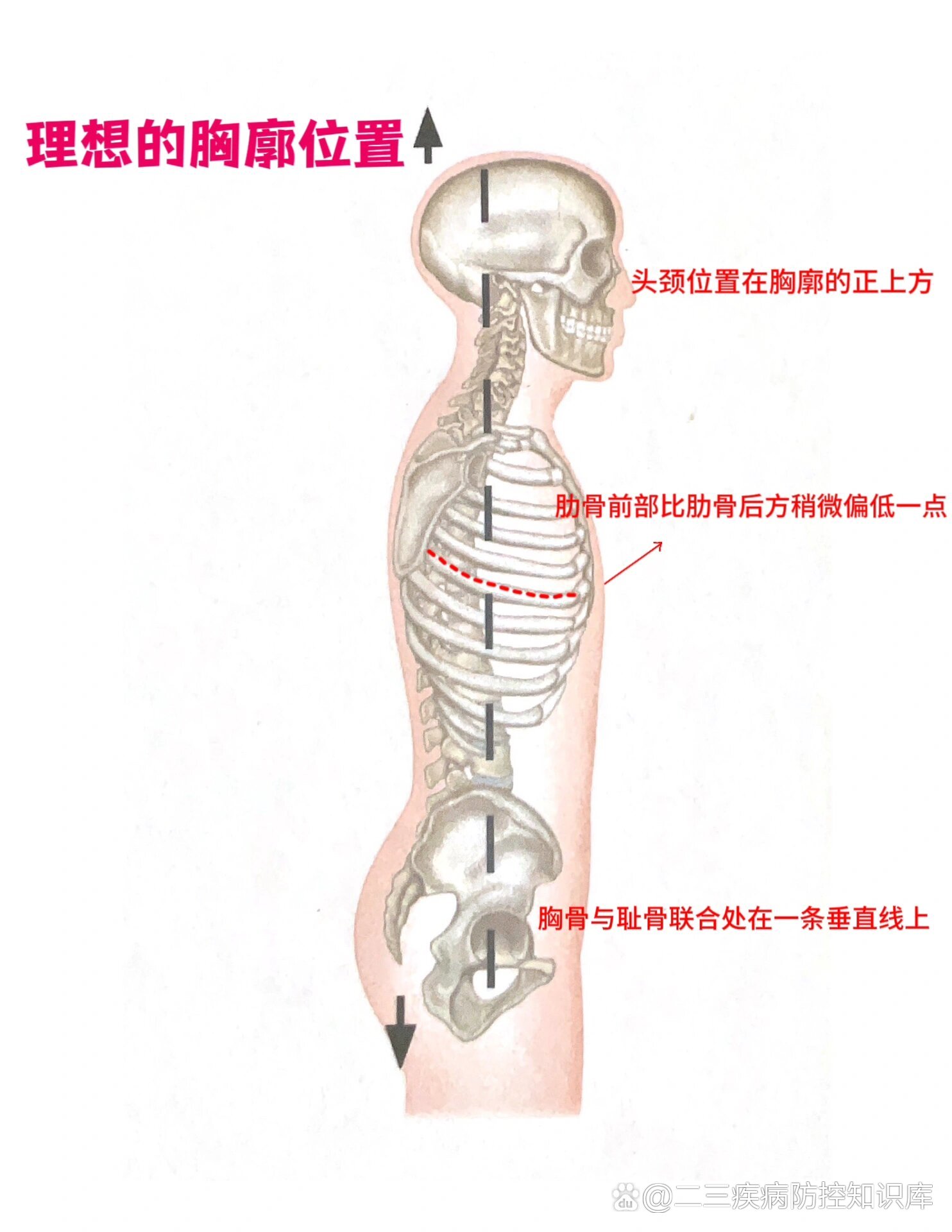 胸廓高图片