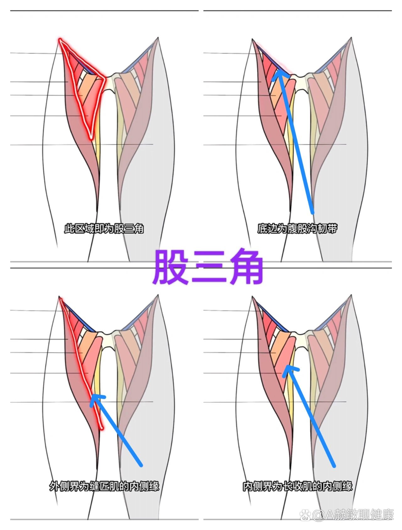 股三角区位于大腿的前内侧上1/3部位,主要是由腹股沟韧带,缝匠肌以及