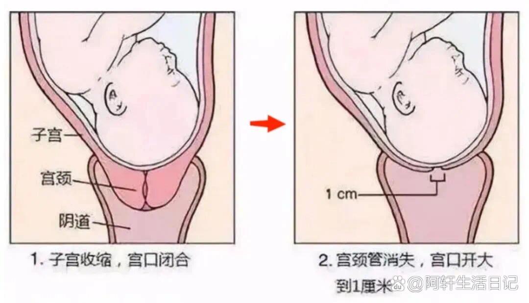 宫颈长度图片图片