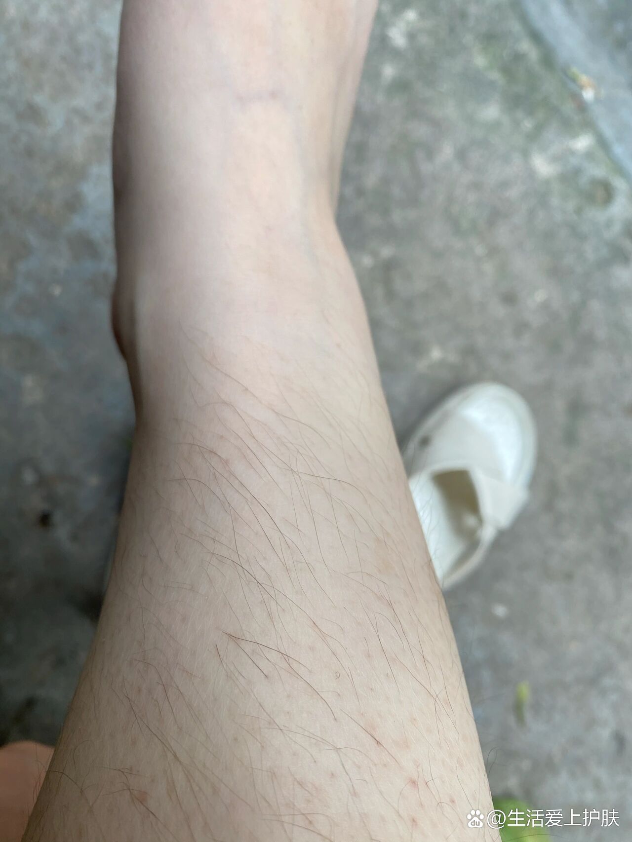 腿毛为什么会突然变得又黑又粗又长050505