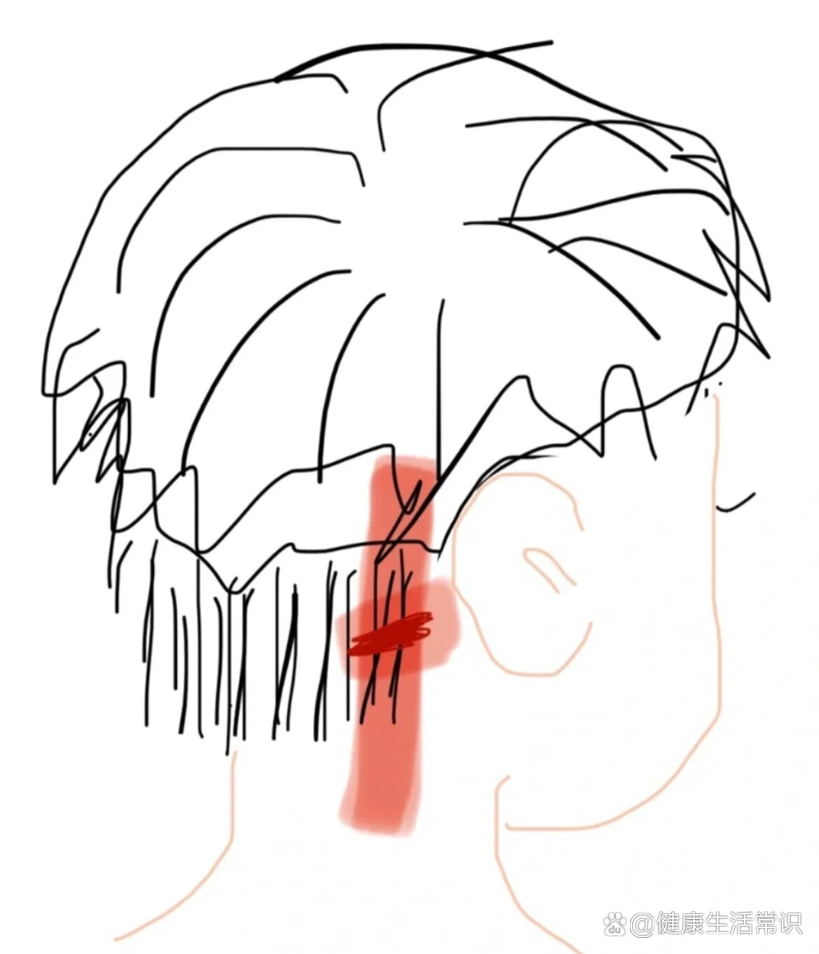  p>枕大神经痛都是怎么好的 br>十天前突然左侧后脑勺耳后酸痛 br>