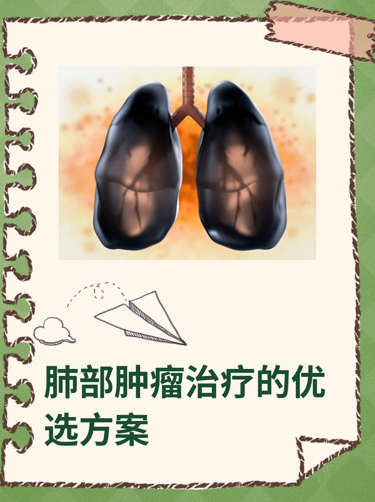 肺部肿瘤治疗的优选方案