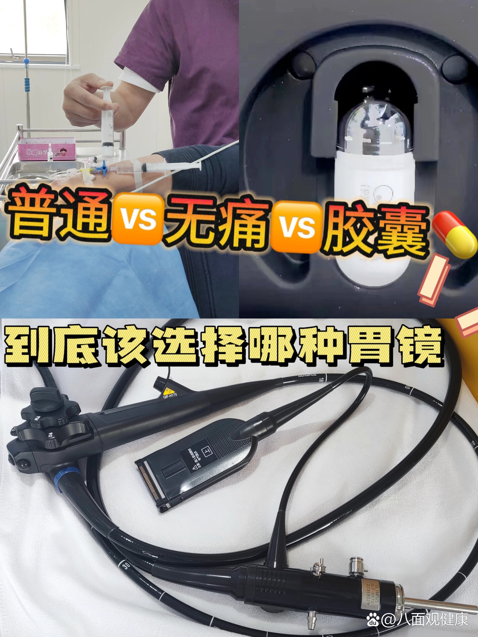 无痛胃镜🆚胶囊胃镜究竟该如何选择❓