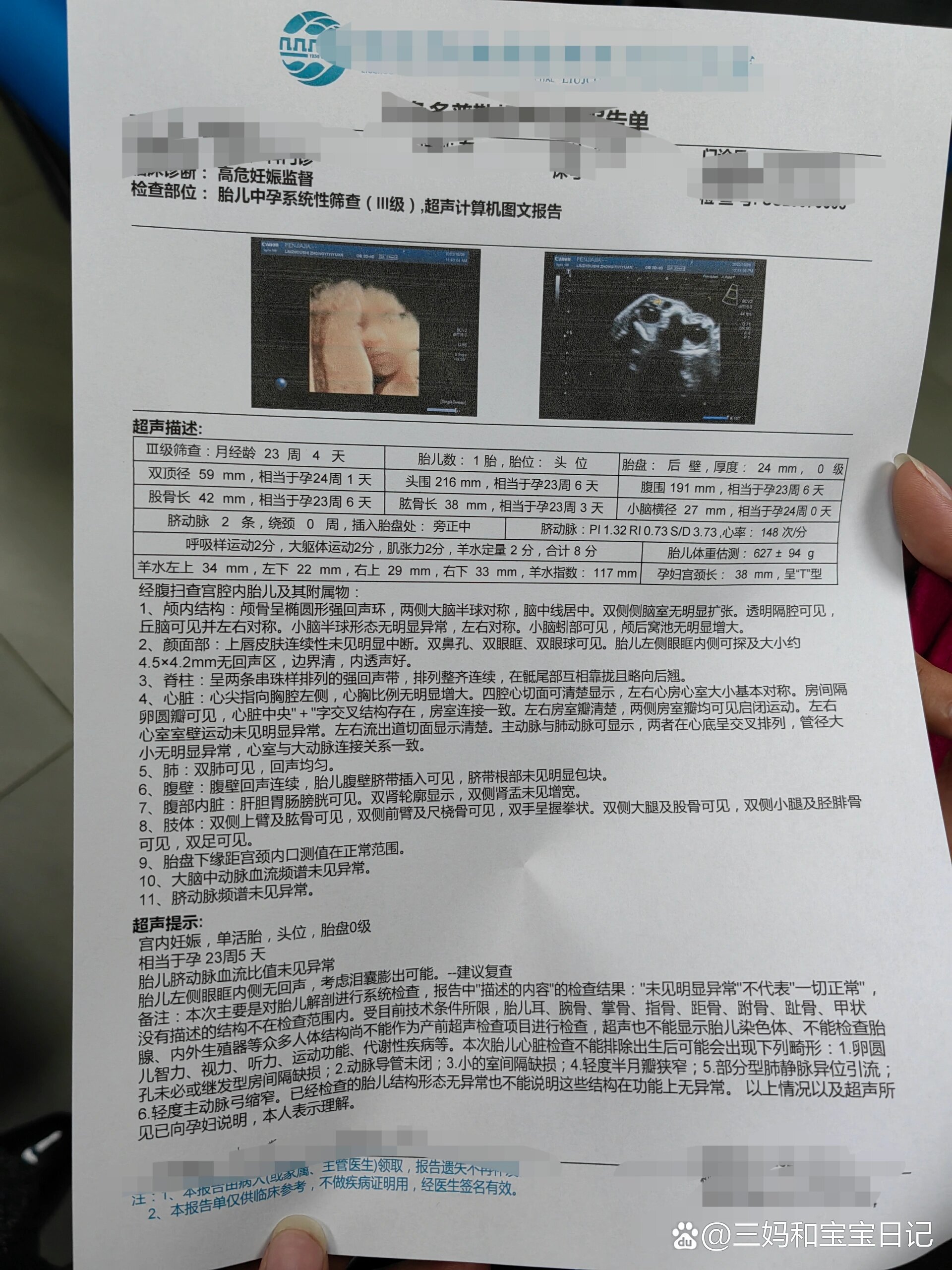 相信谁都不想搜到四维检查胎儿鼻泪管囊肿的词条吧 br>连续两天的检查