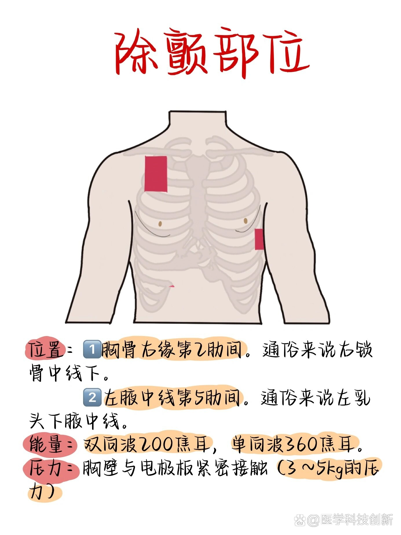 除颤仪位置图片图片