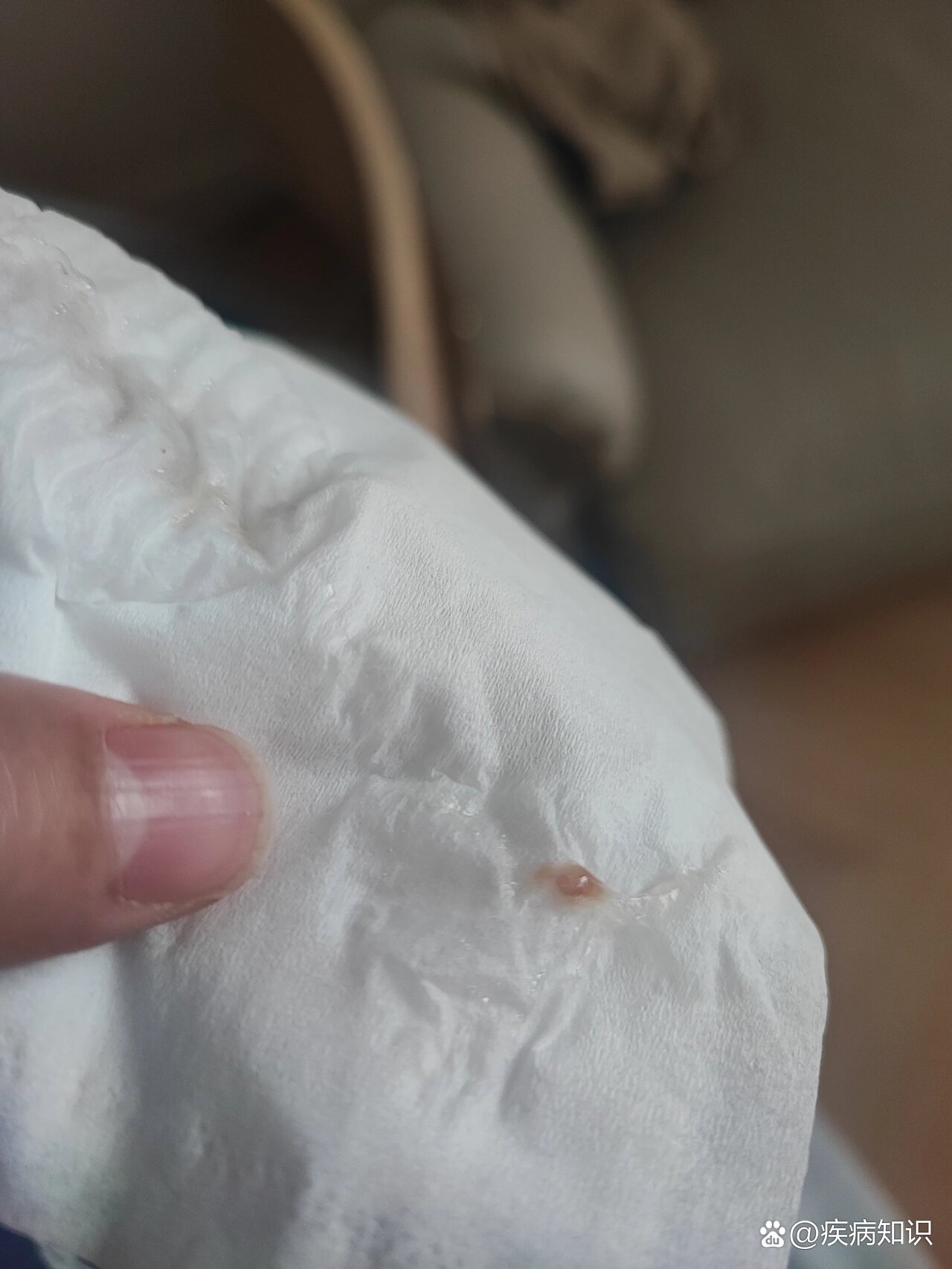 鼻咽肿物,回吸痰