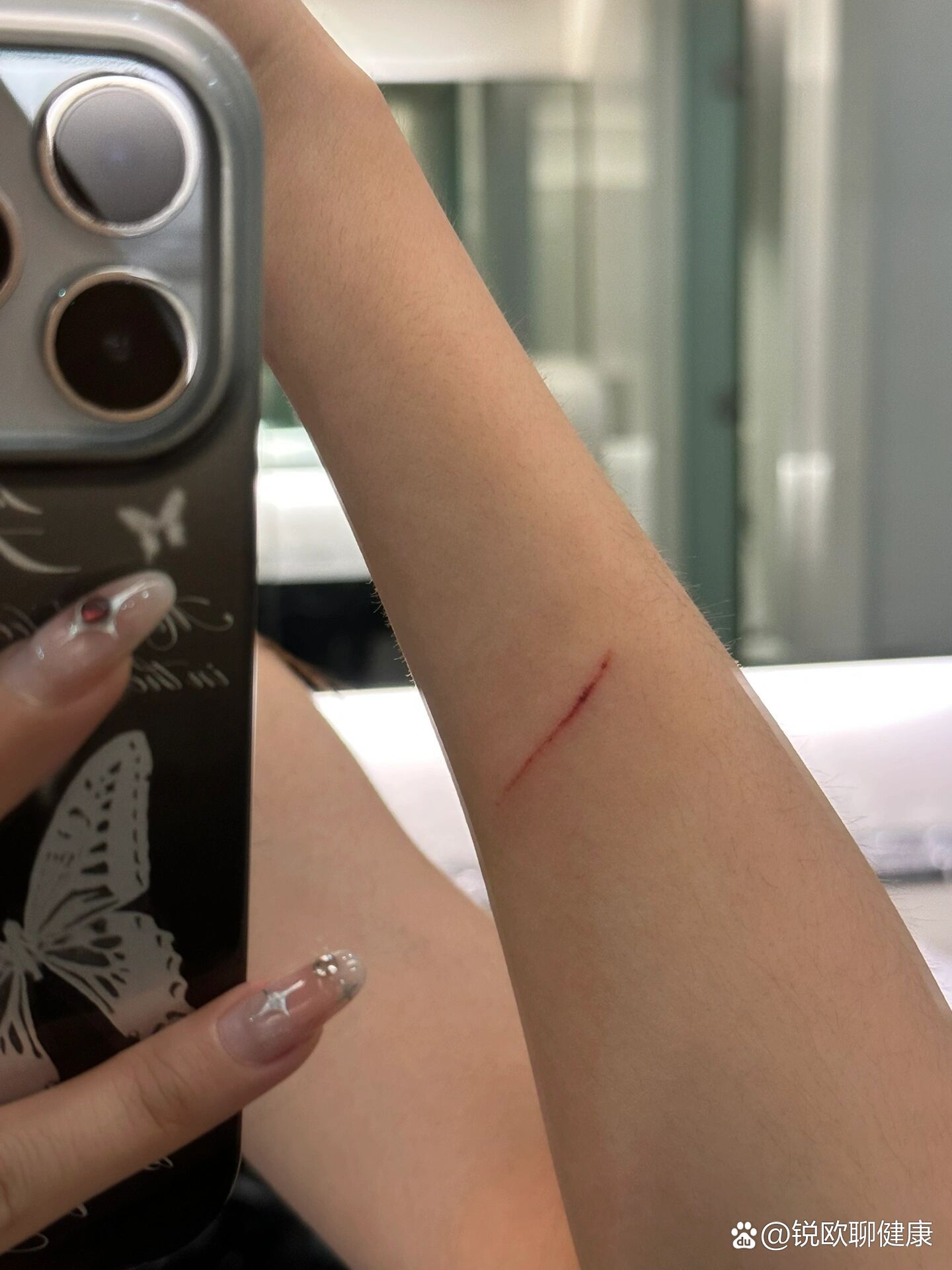 一觉起来发现划伤