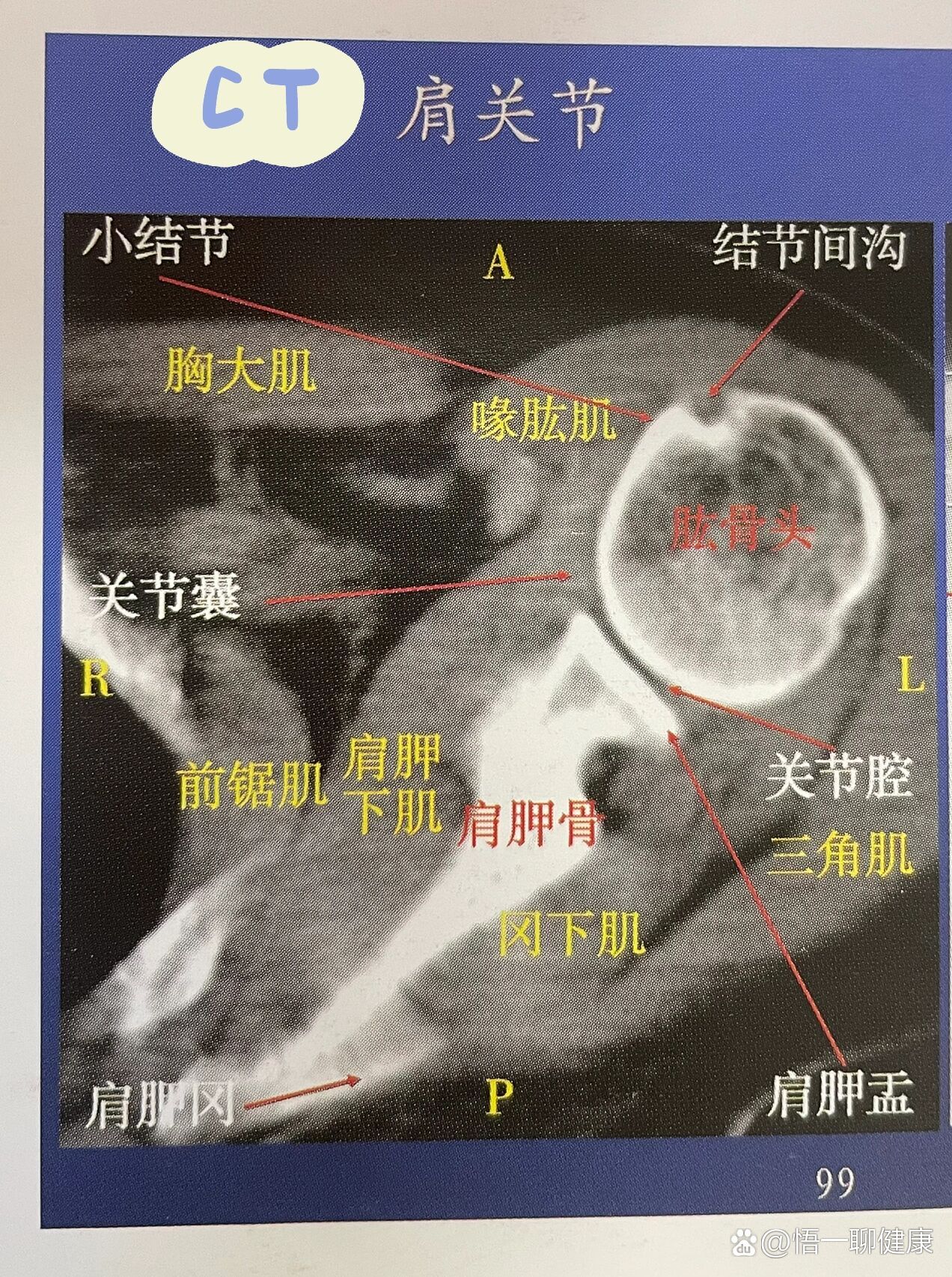 ct之肩关节横断面解剖