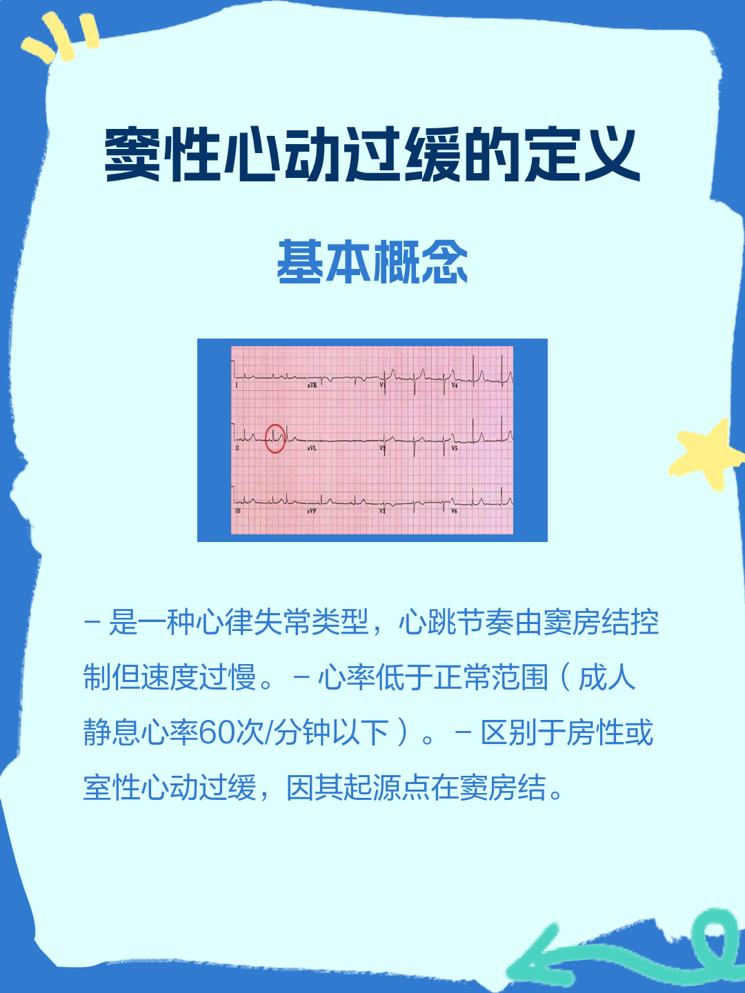 窦性心动过缓是什么意思| 百度健康·医学科普