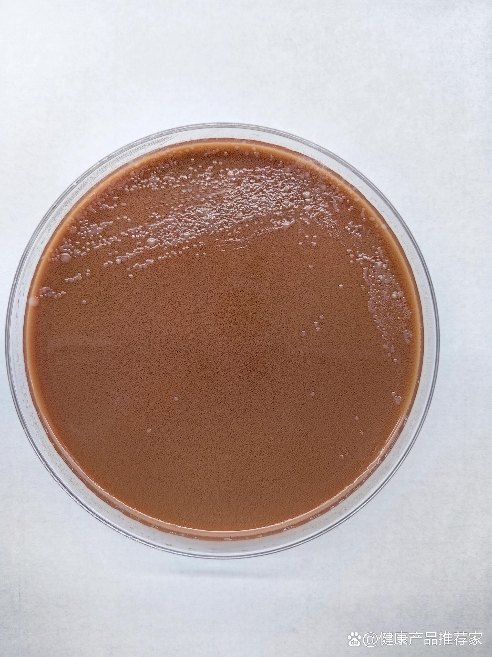  p>卡他莫拉 br>莫拉菌属(moraxella)与不动杆菌属同属莫拉菌科,共有