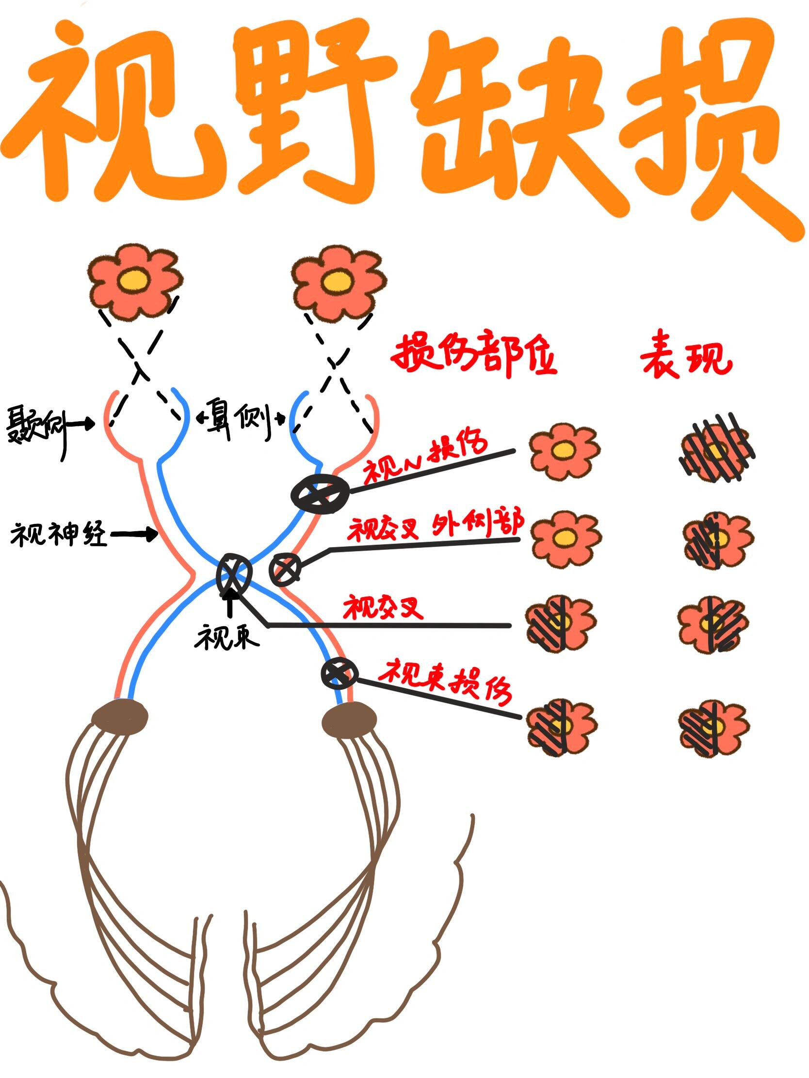 手写笔记|视野