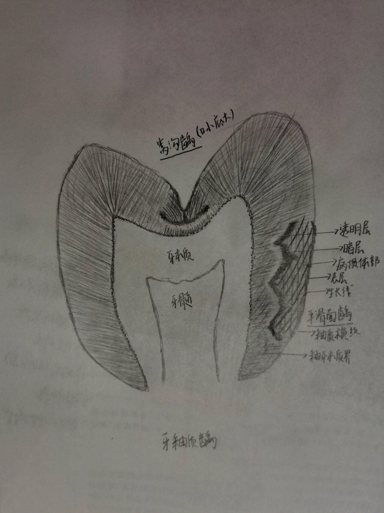 牙齿形态解剖图素描图片