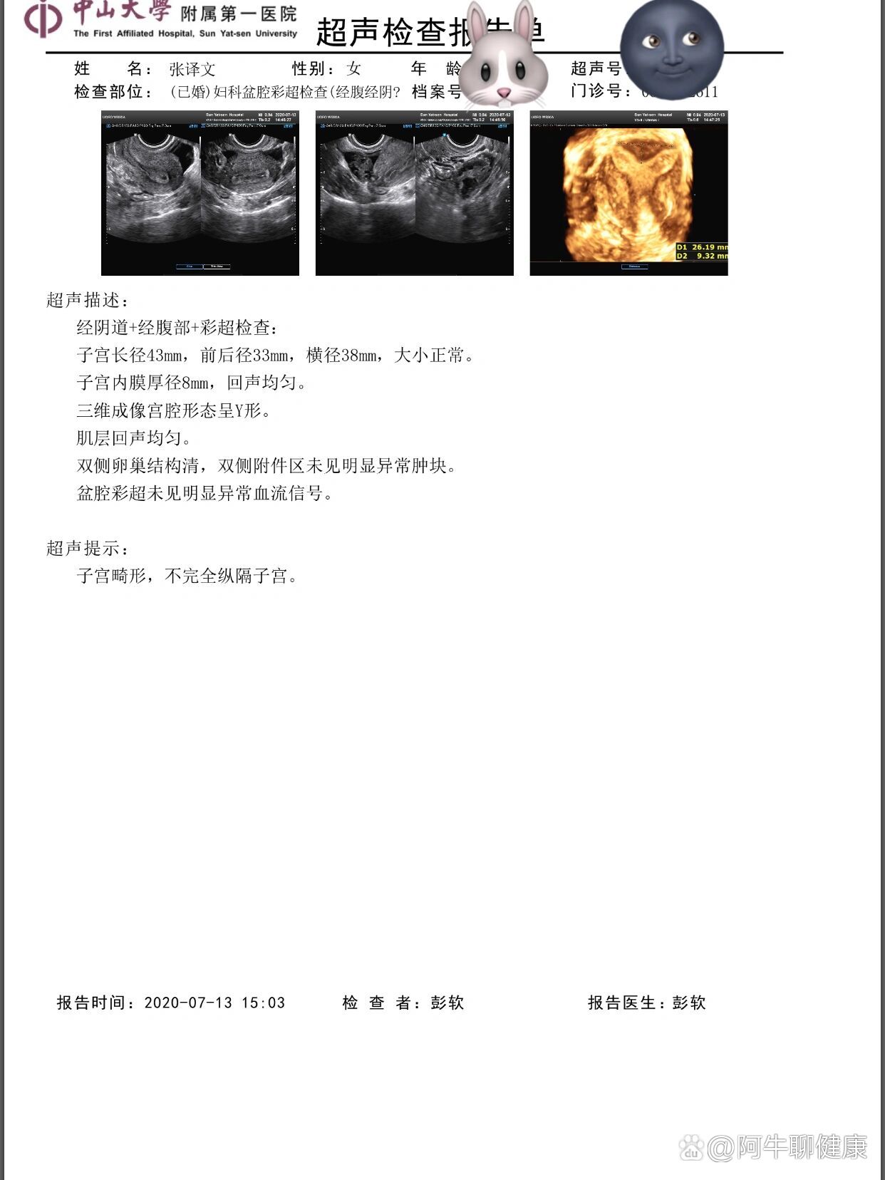 纵隔子宫怀孕图片8月图片