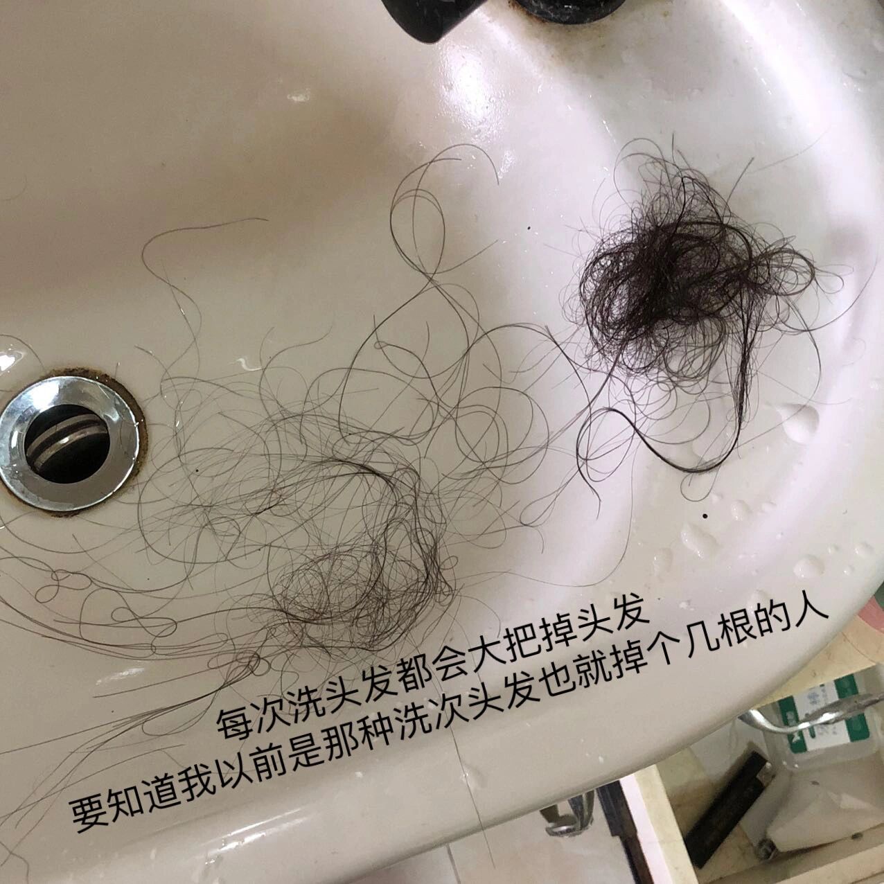 关于系统性红斑狼疮脱发