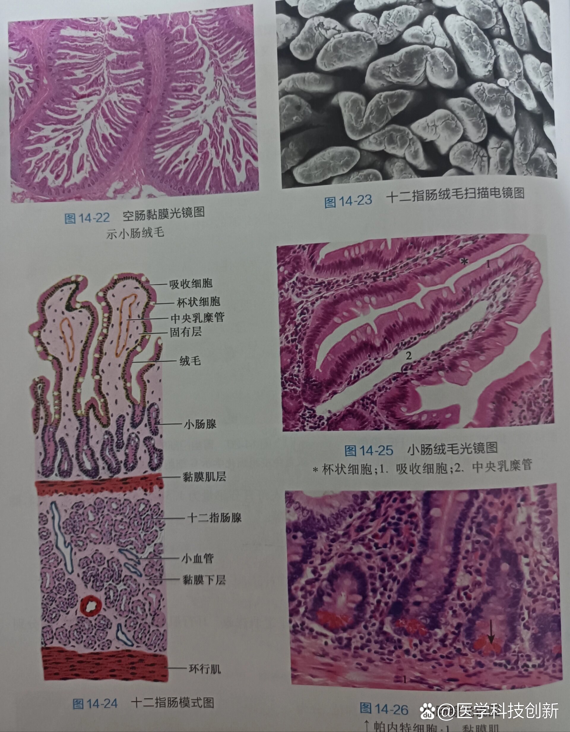 小肠袢图片图片