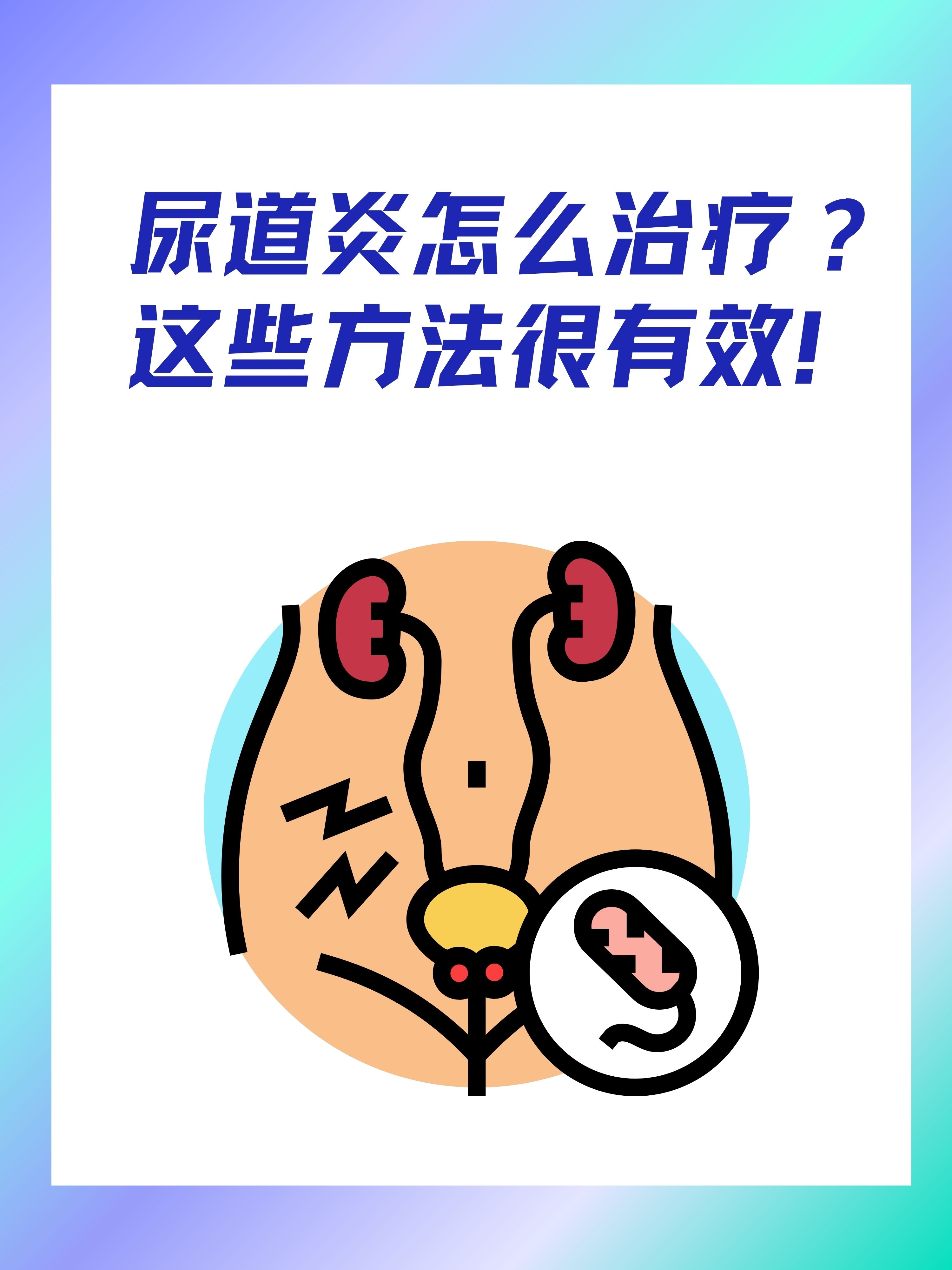 尿道炎怎么治疗?这些方法很有效!