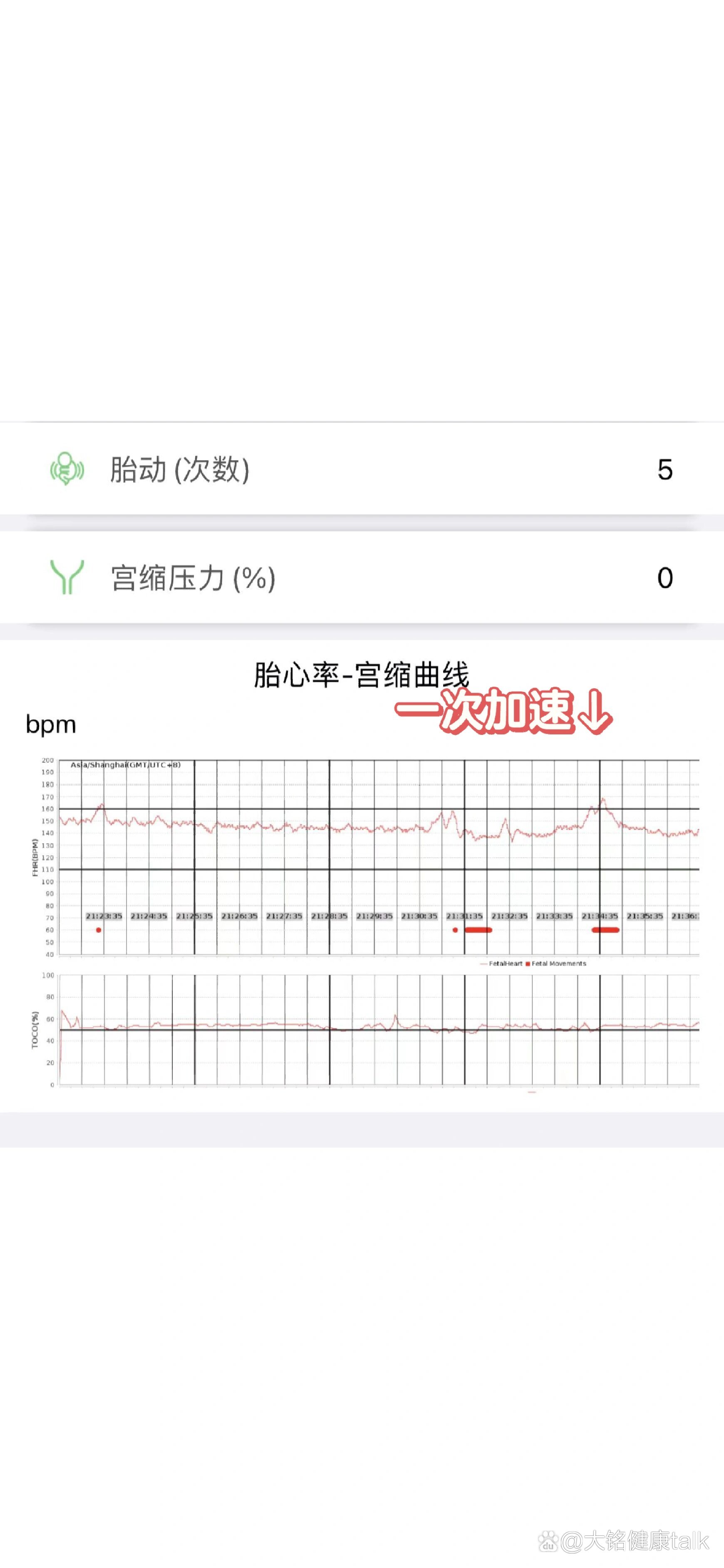 如何读懂胎心监护图