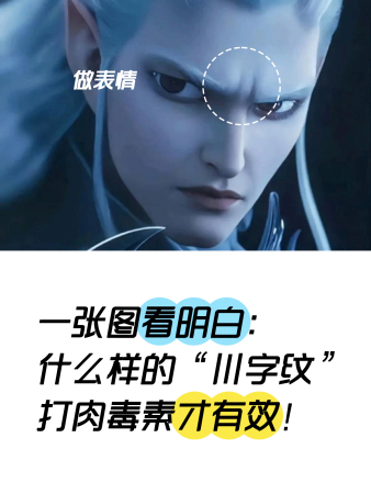 一张图看明白：什么样的“川字纹”打肉毒素才有效！