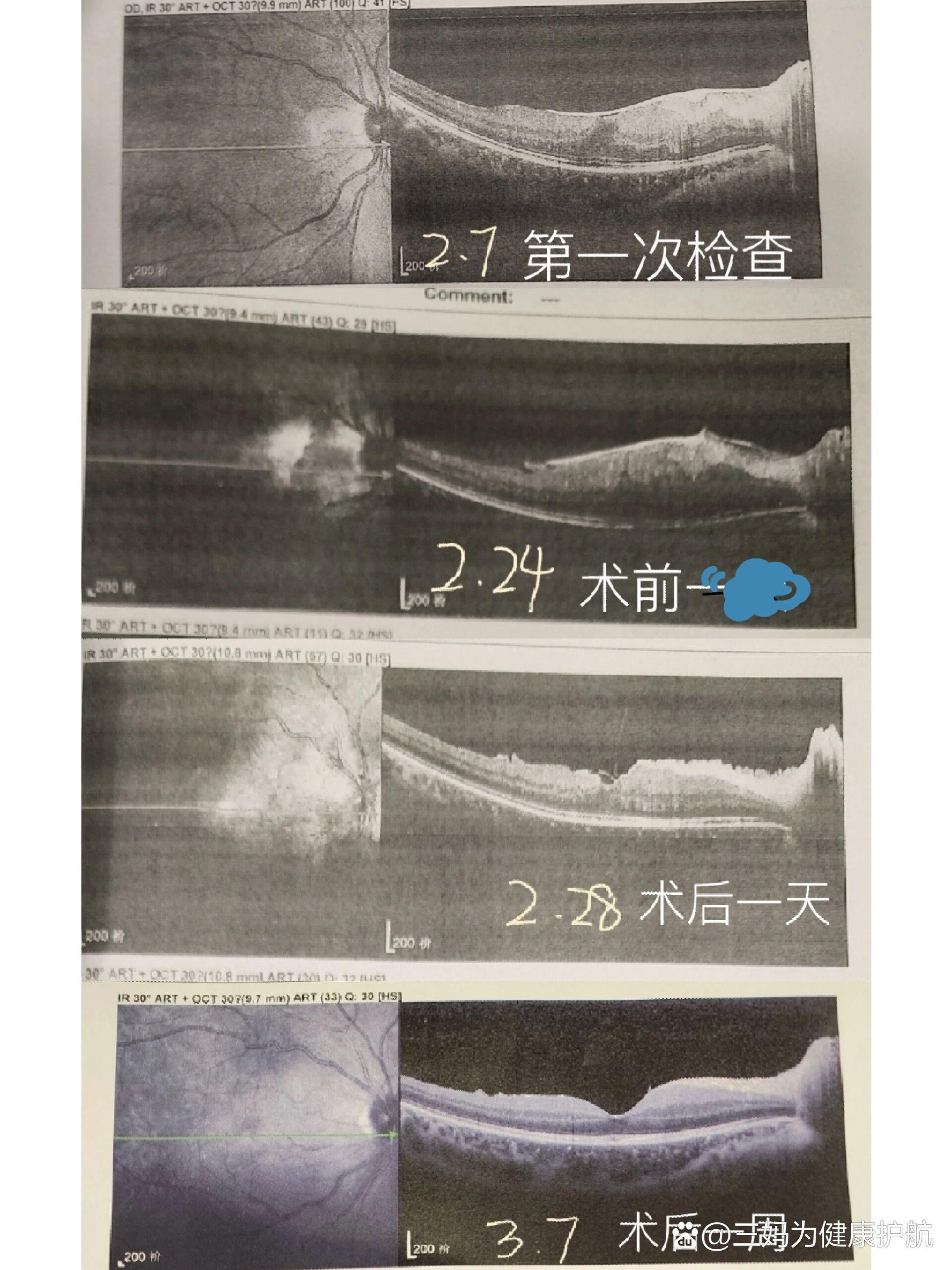 身上长黄斑图片