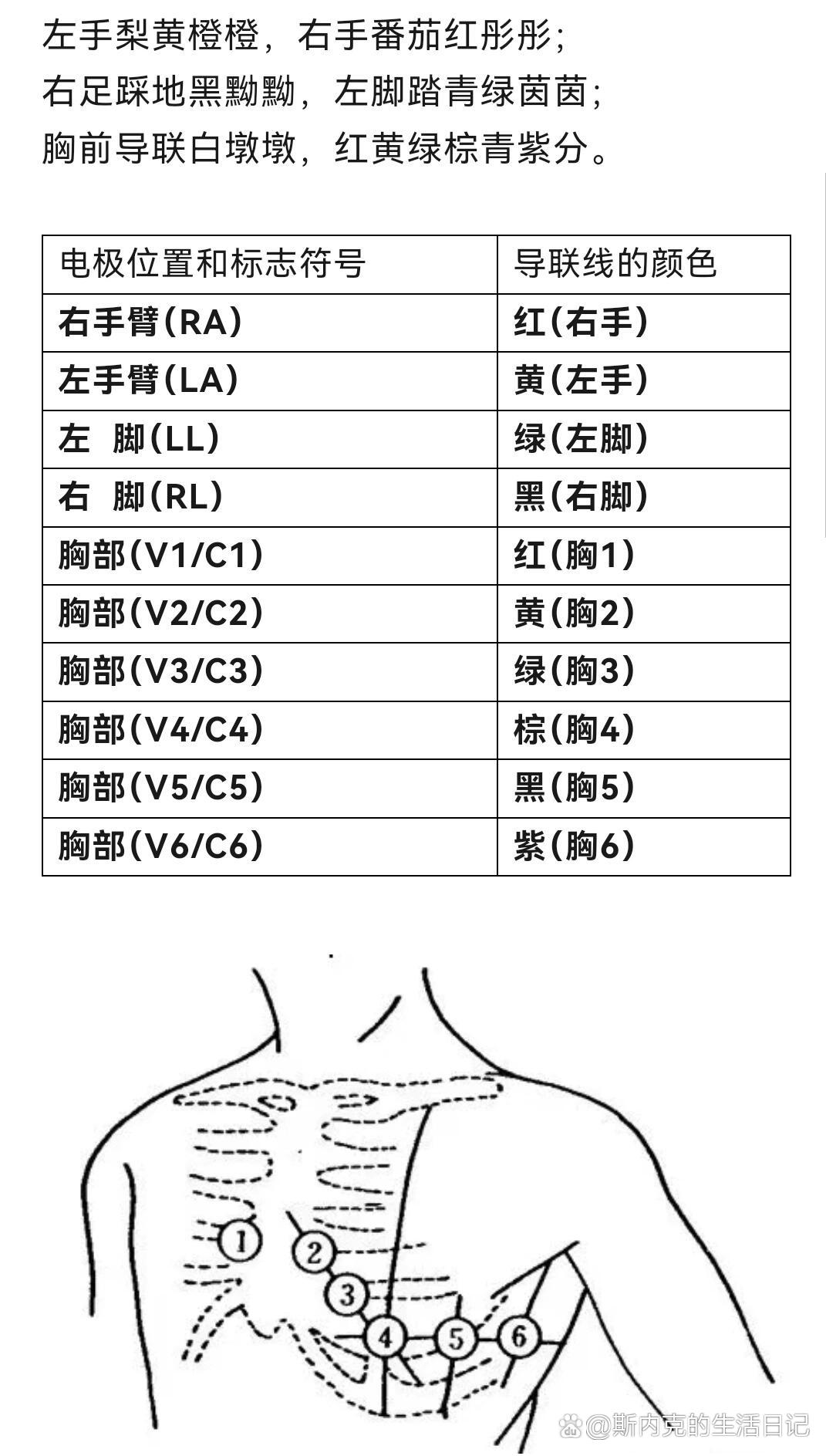 心电图测量位置图解图片