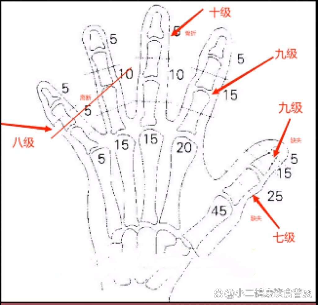 手指缺失分值图图片