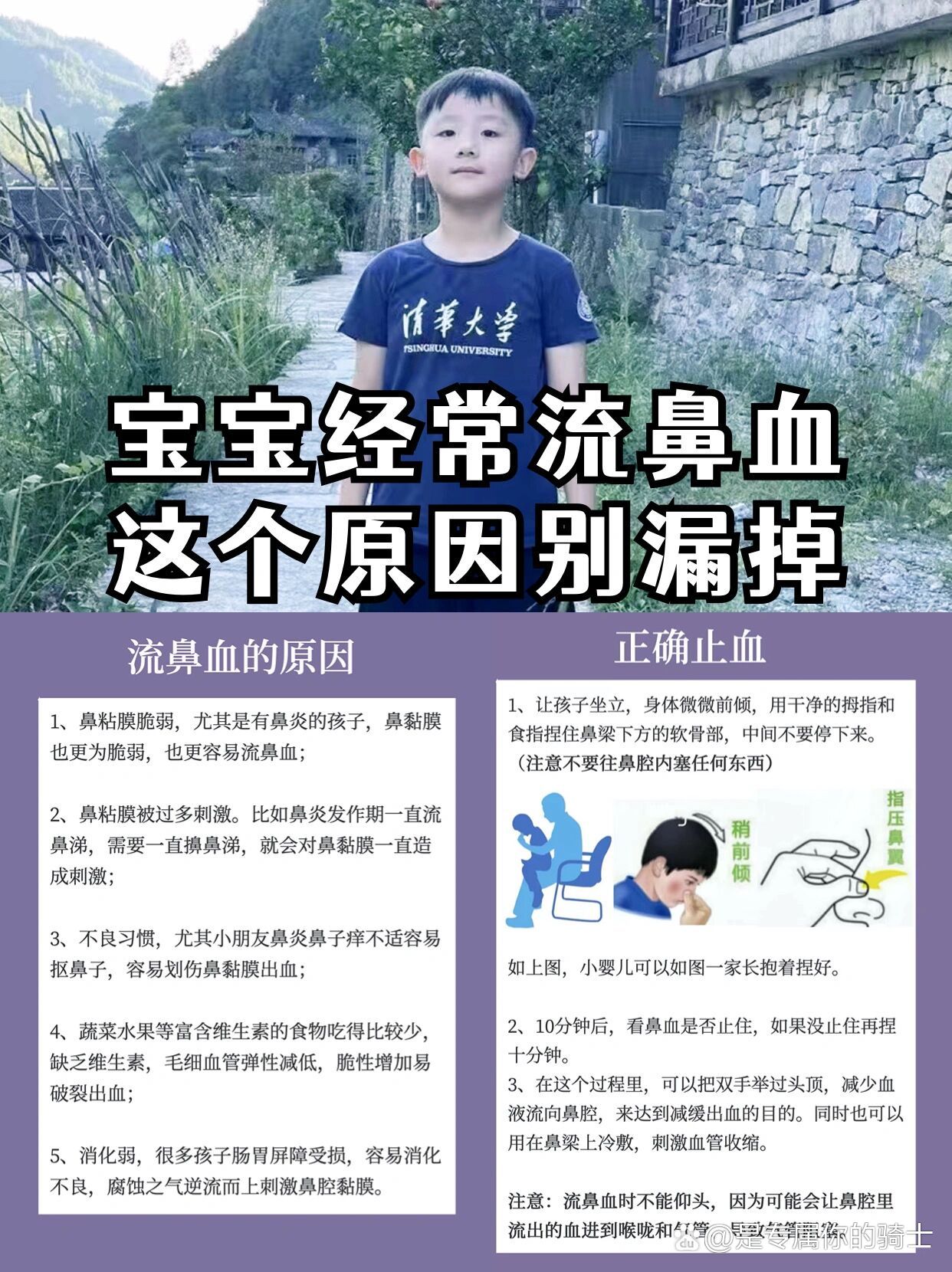 流鼻血怎么回事图片