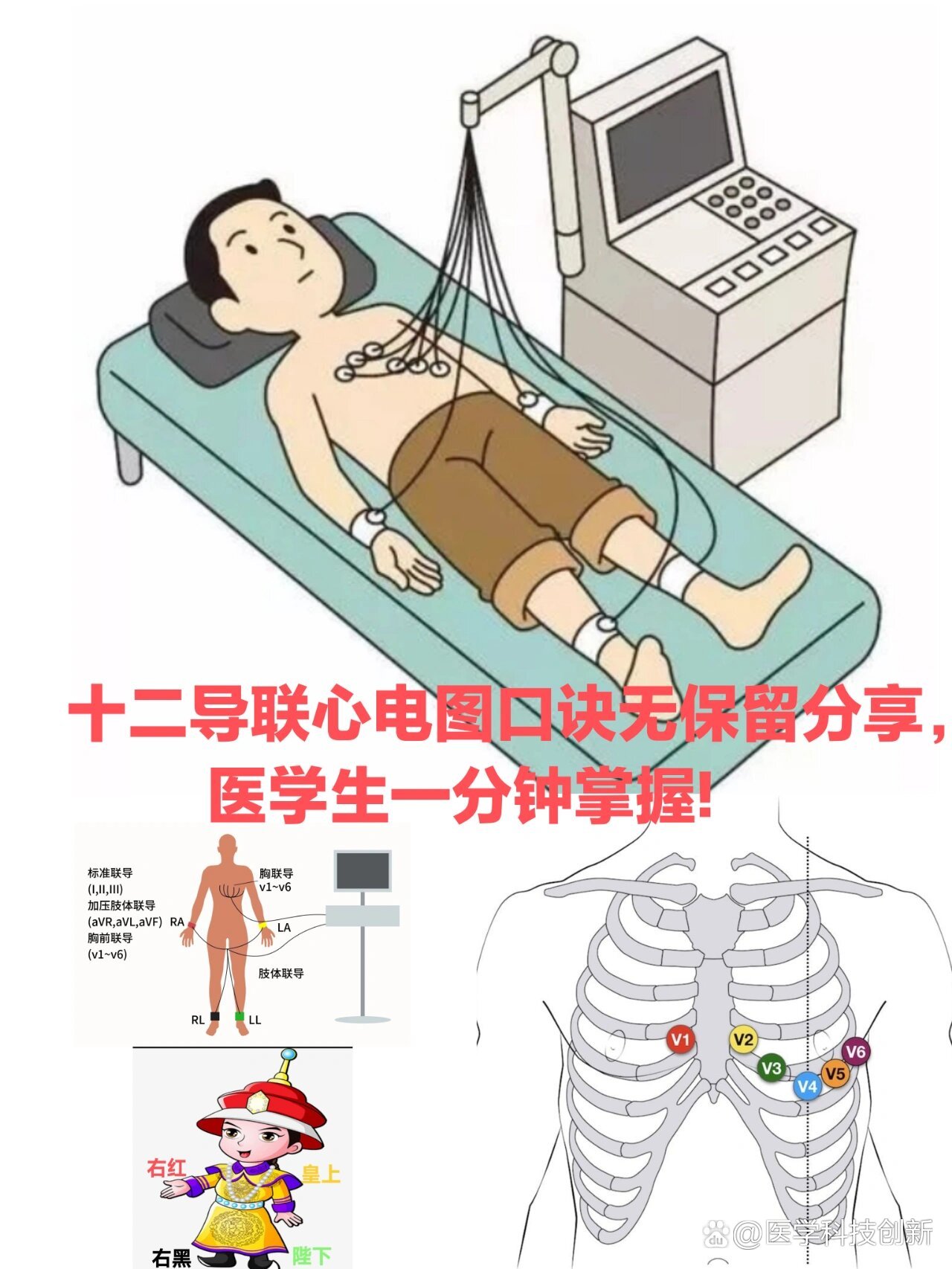 心电图导联真人图图片