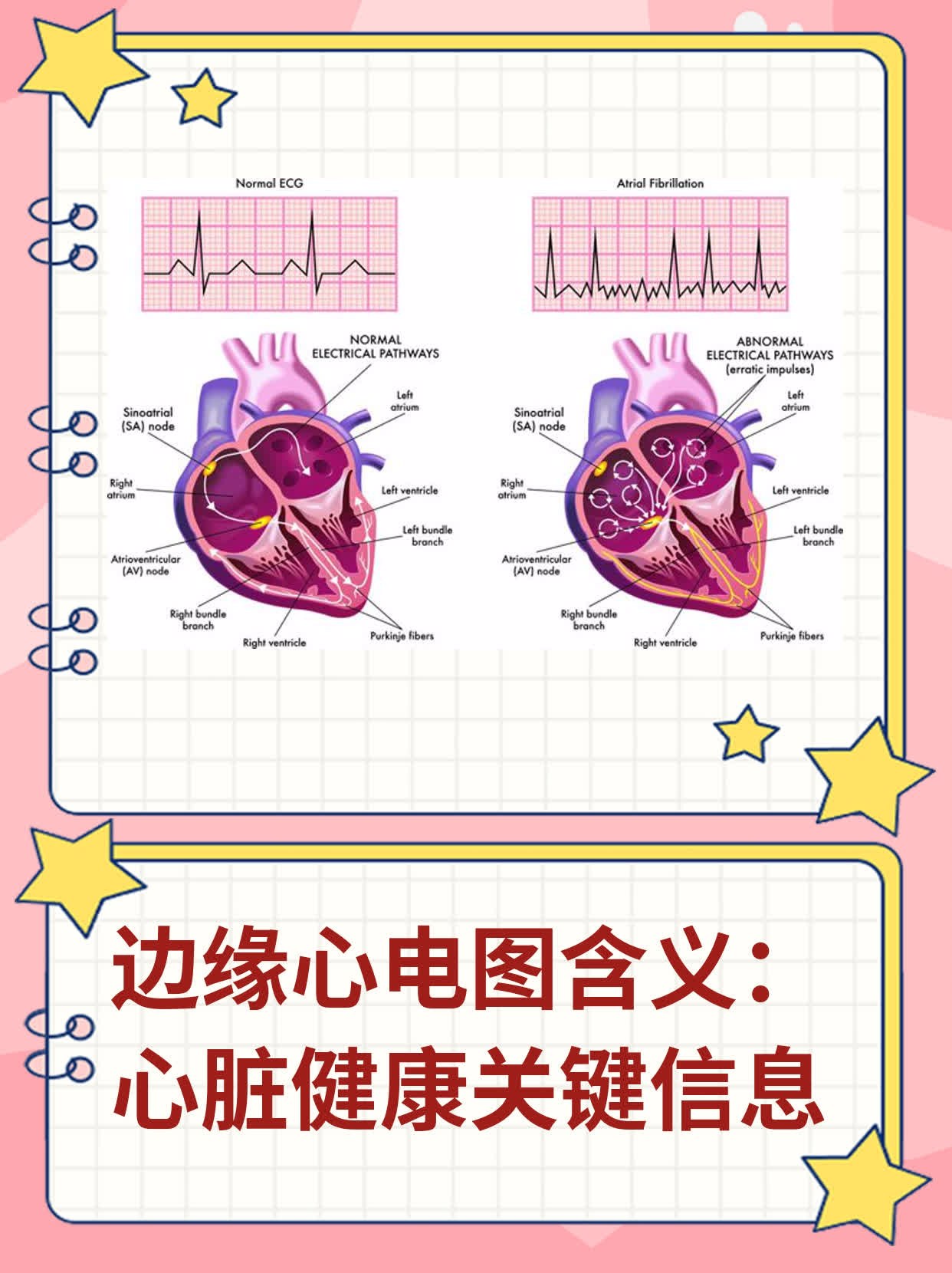 心电图宣传图片大全图片