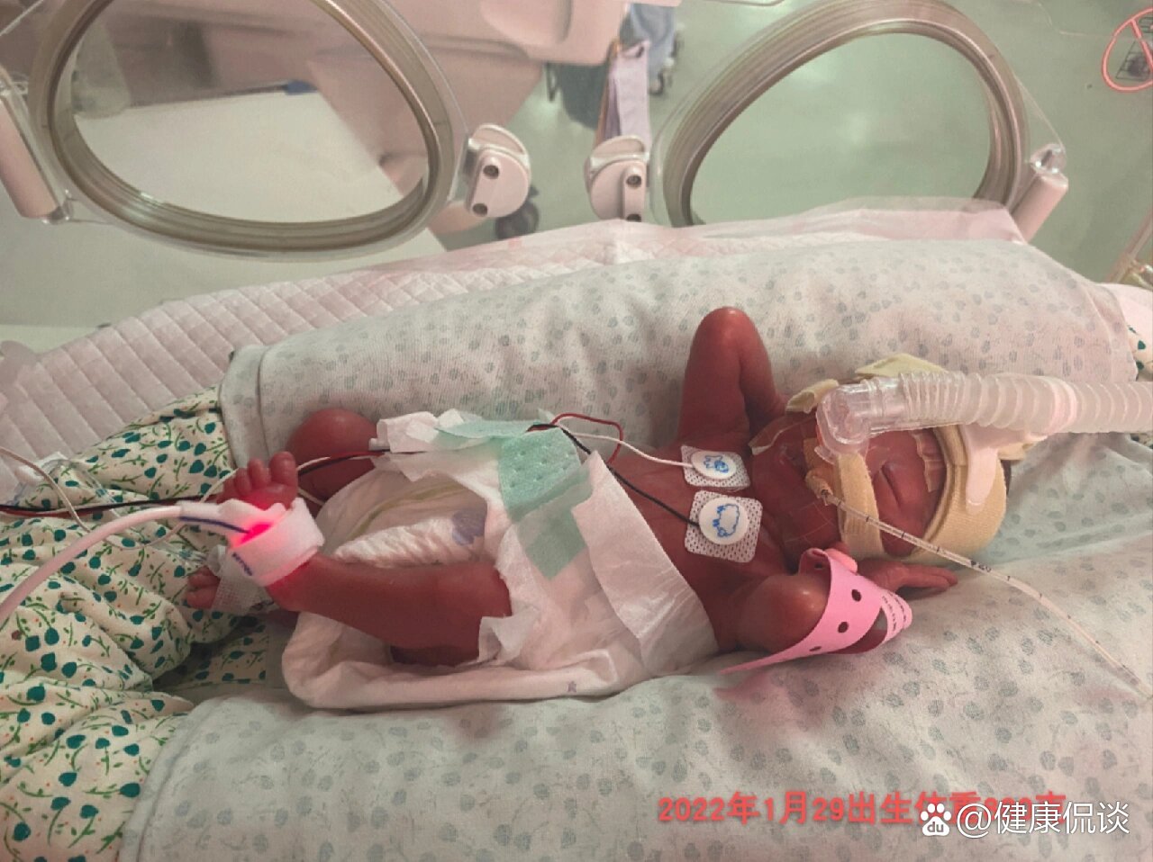 27周早产880克目前已18斤