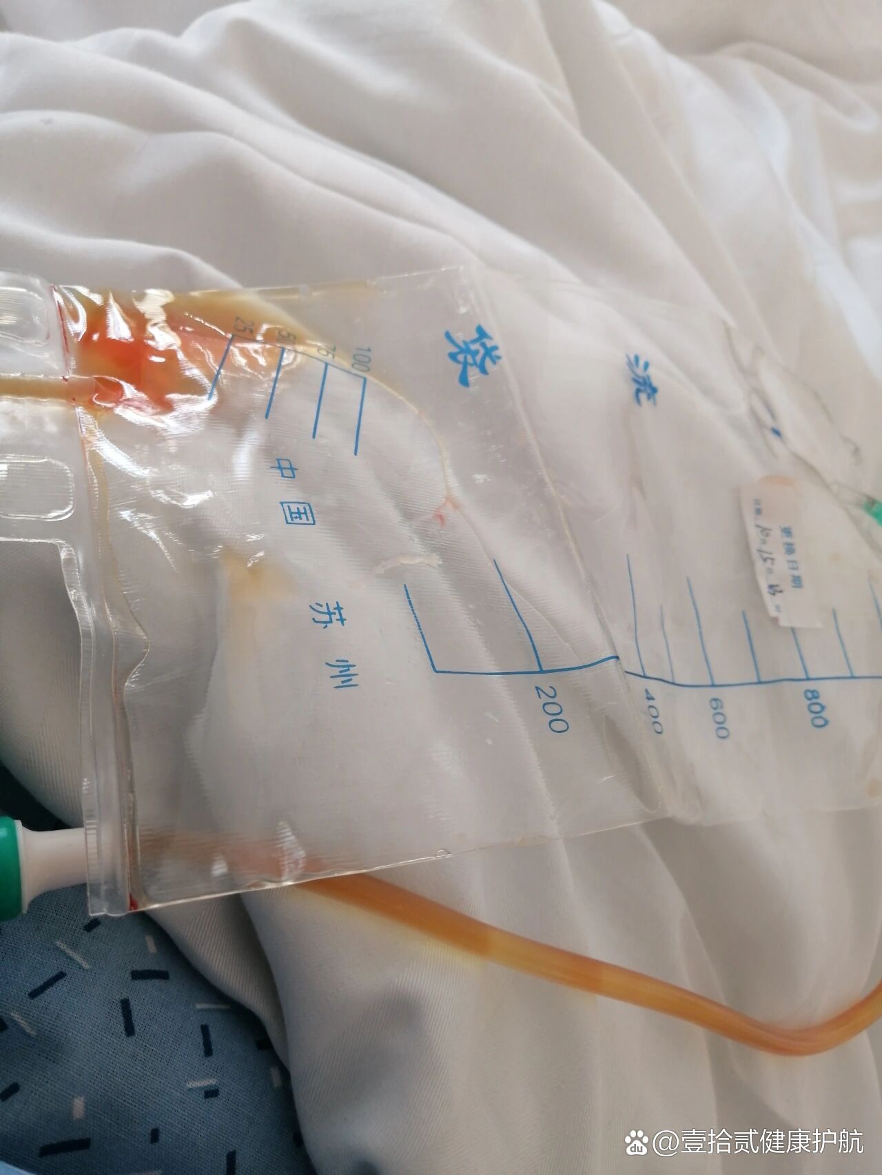 甲癌术后,引流液这个颜色是淋巴漏吗?