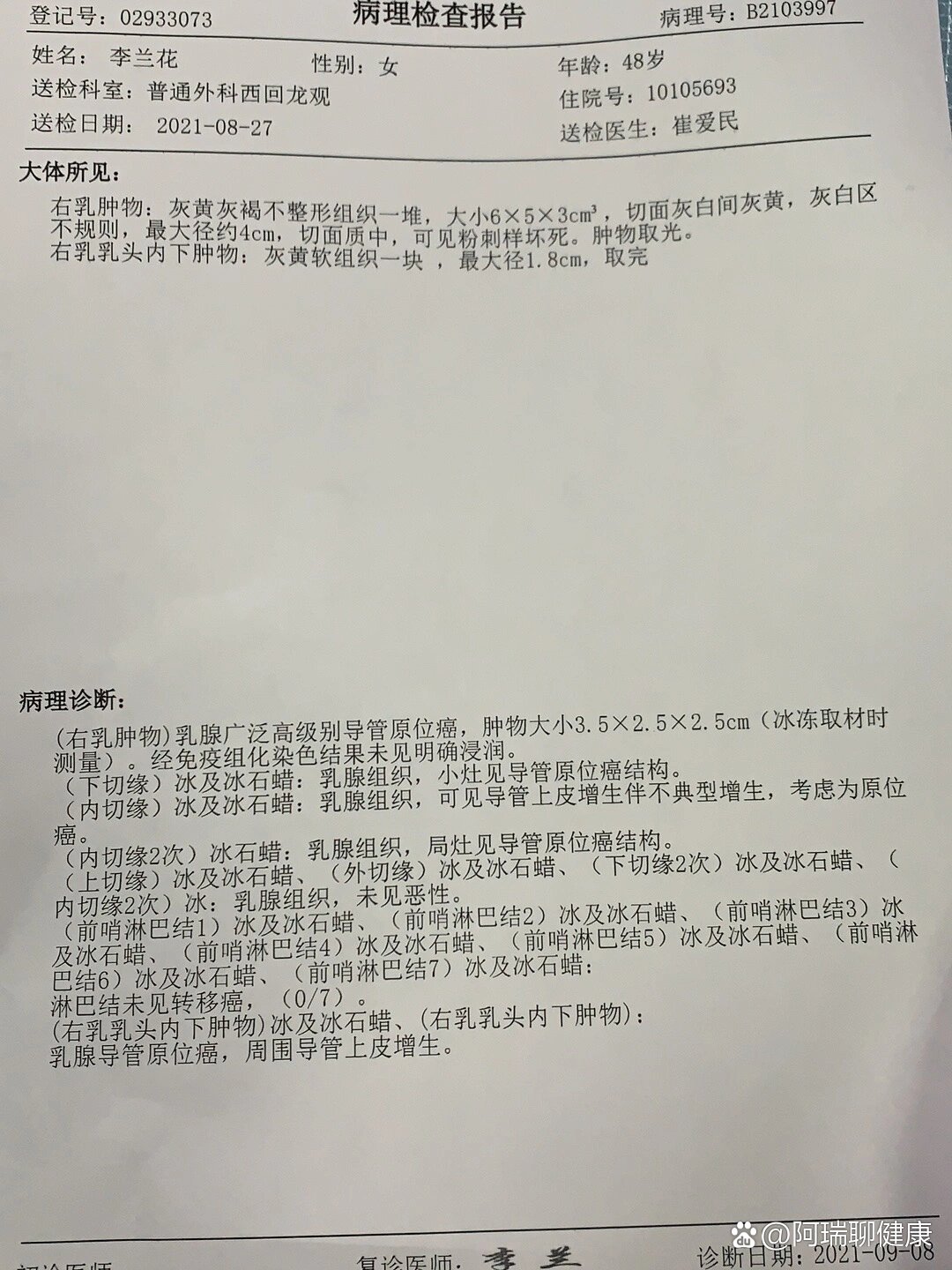 乳腺癌高级别导管原位癌
